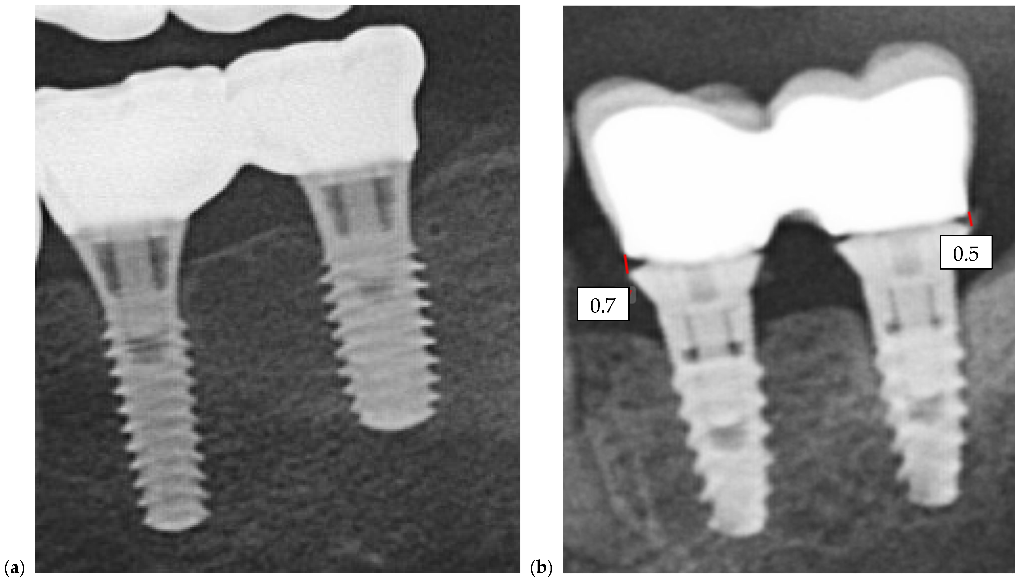 Prosthesis 07 00135 g007