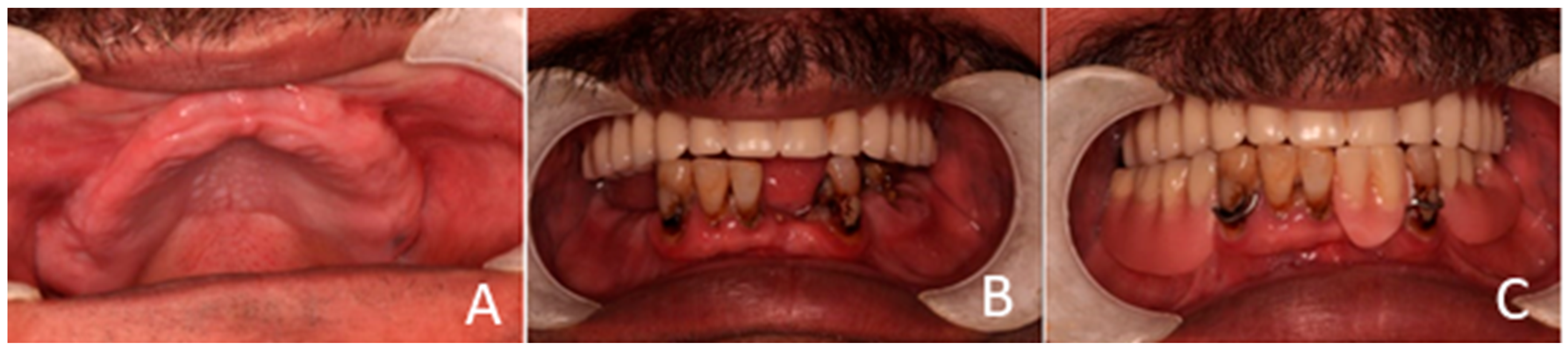 Prosthesis 07 00145 g001