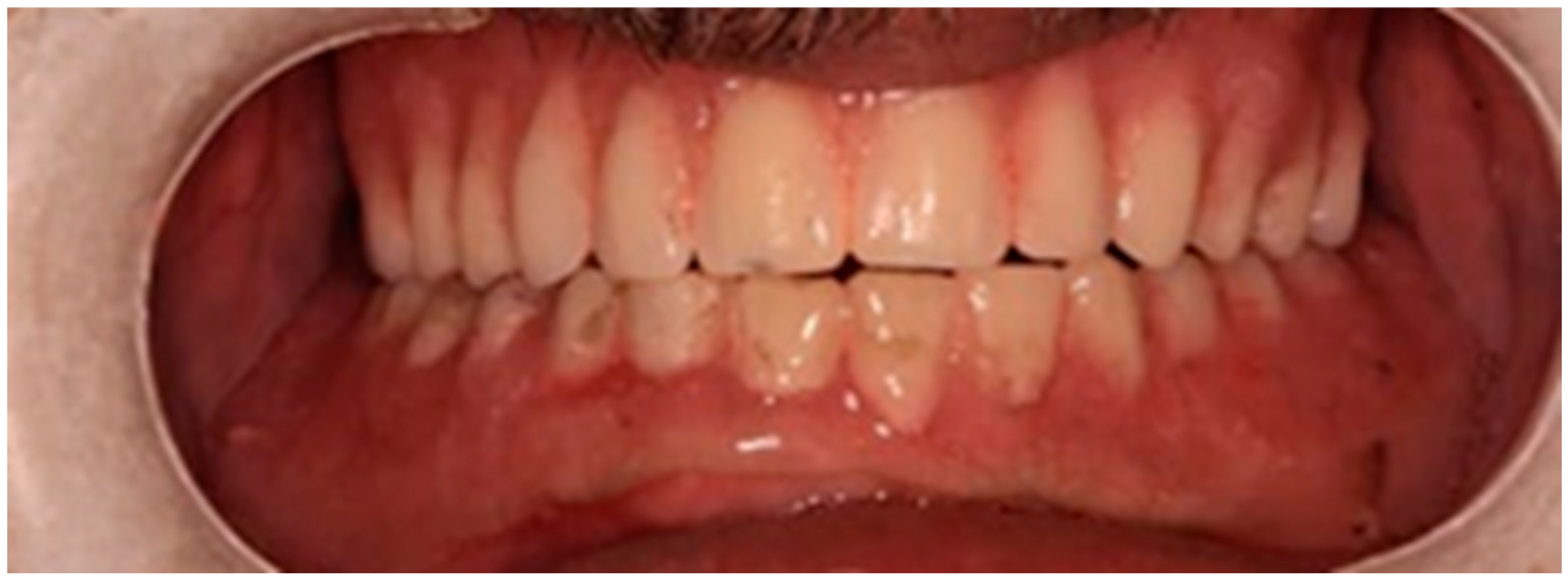 Prosthesis 07 00145 g003