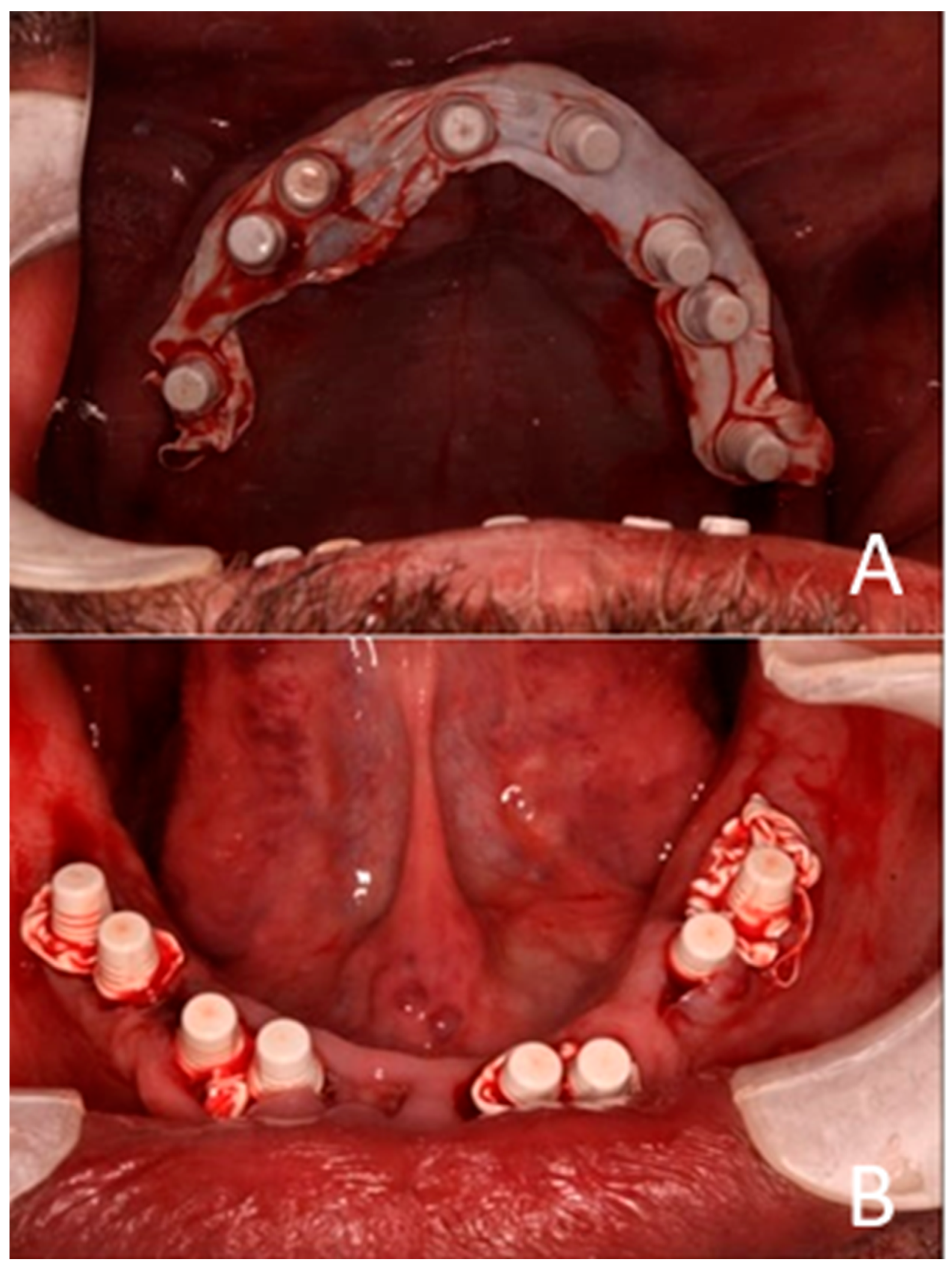 Prosthesis 07 00145 g007