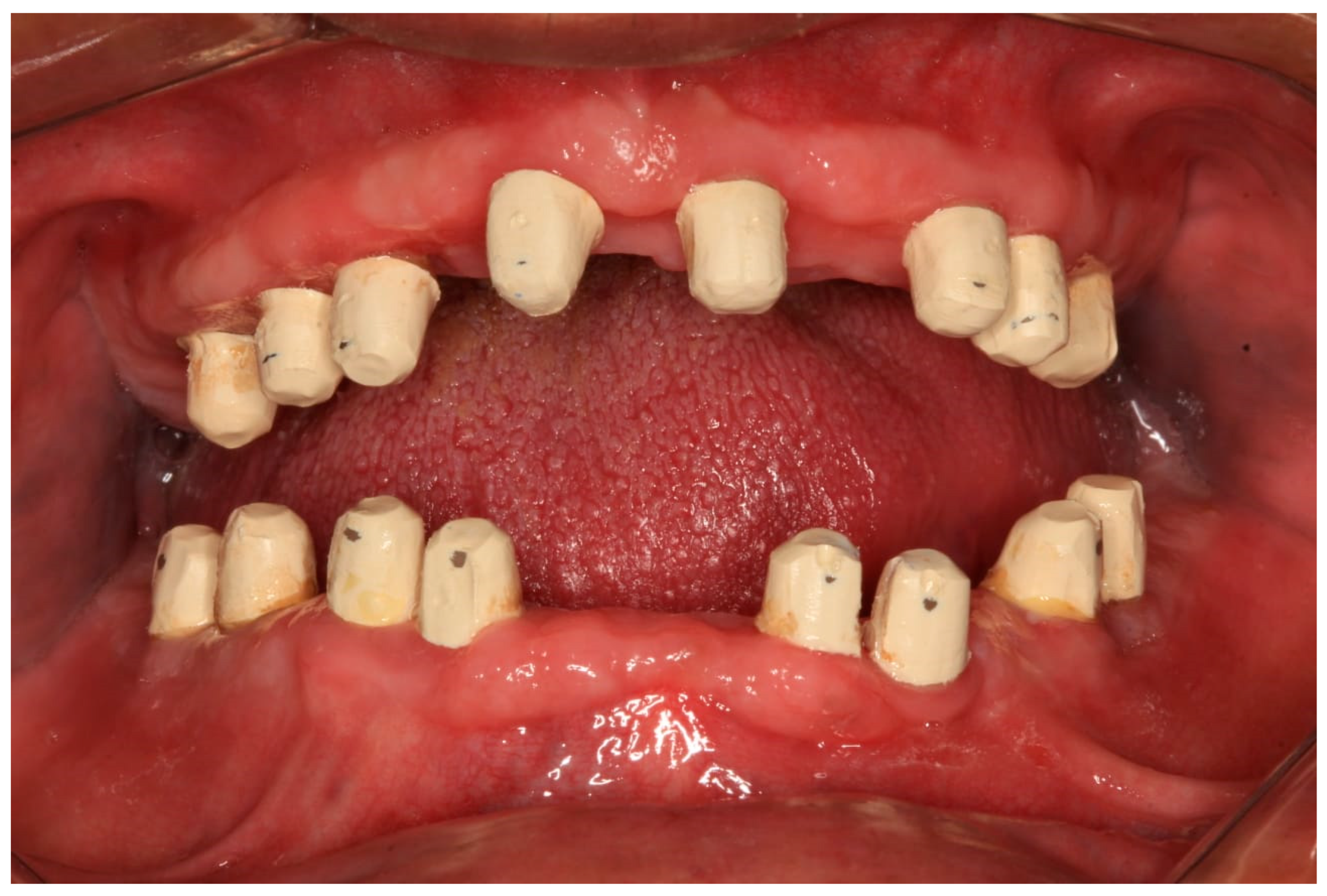 Prosthesis 07 00145 g012