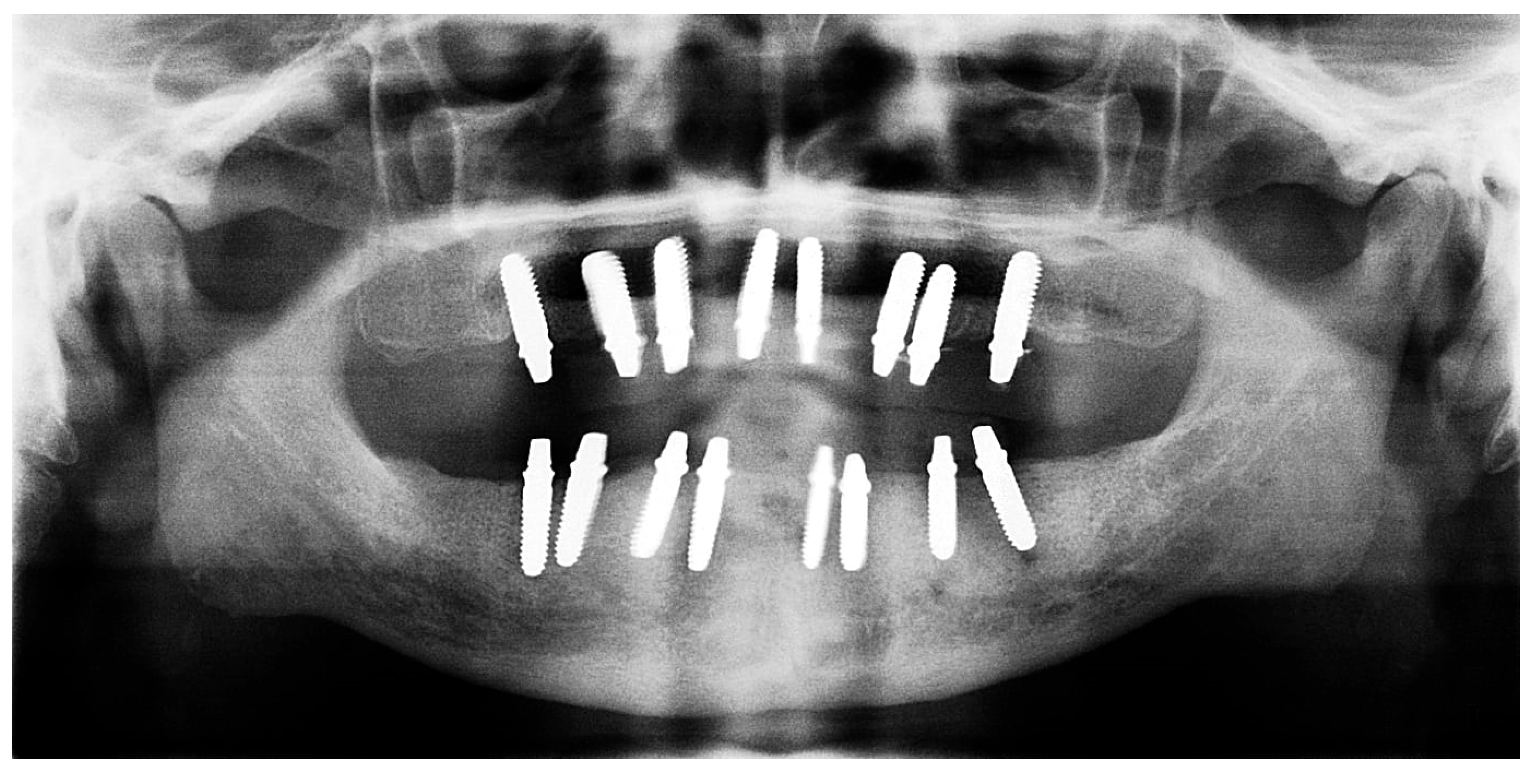 Prosthesis 07 00145 g013