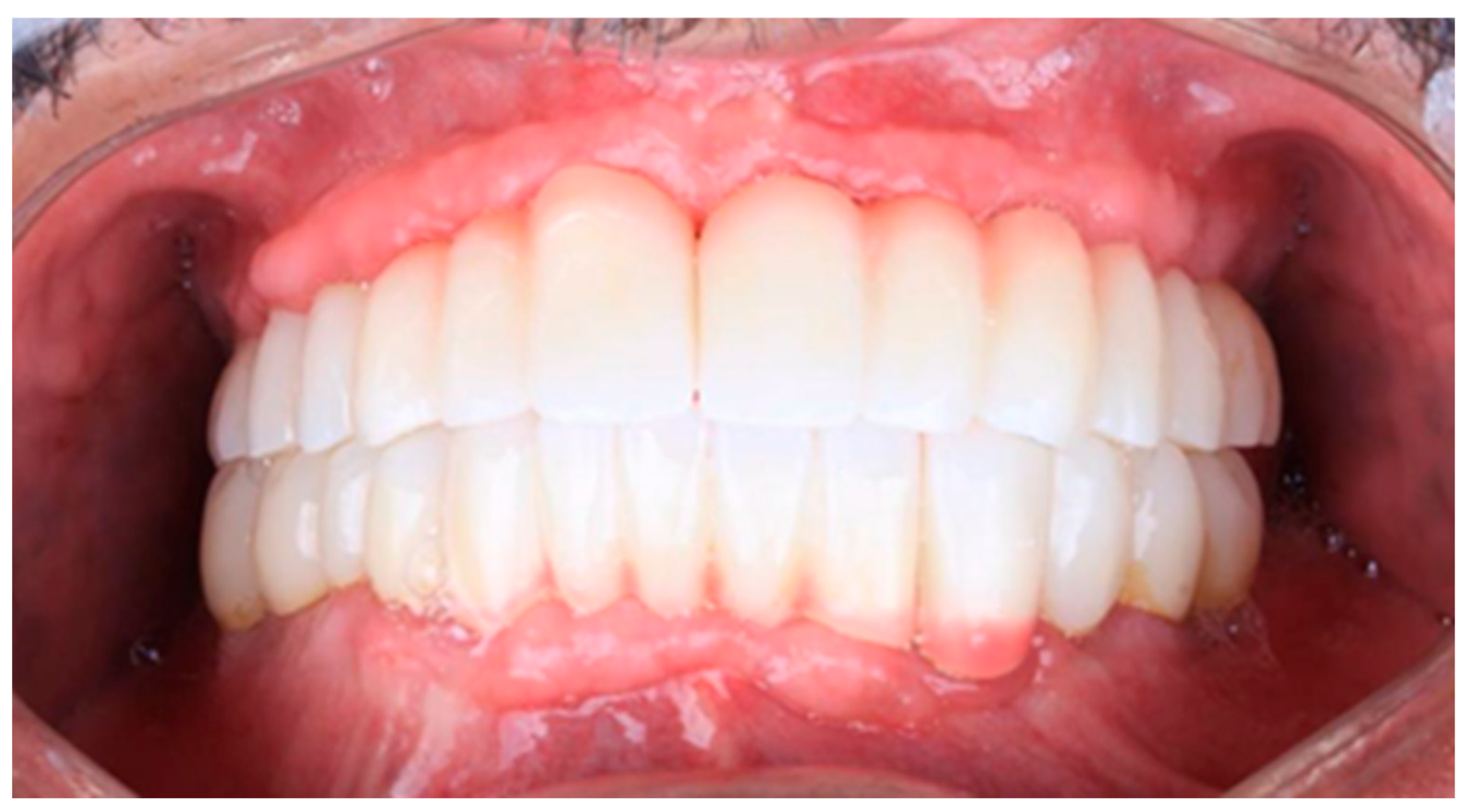 Prosthesis 07 00145 g014