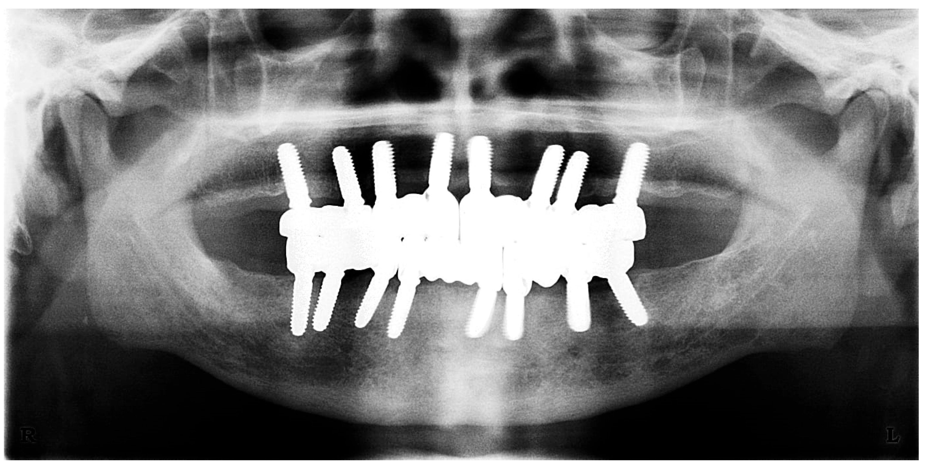 Prosthesis 07 00145 g015