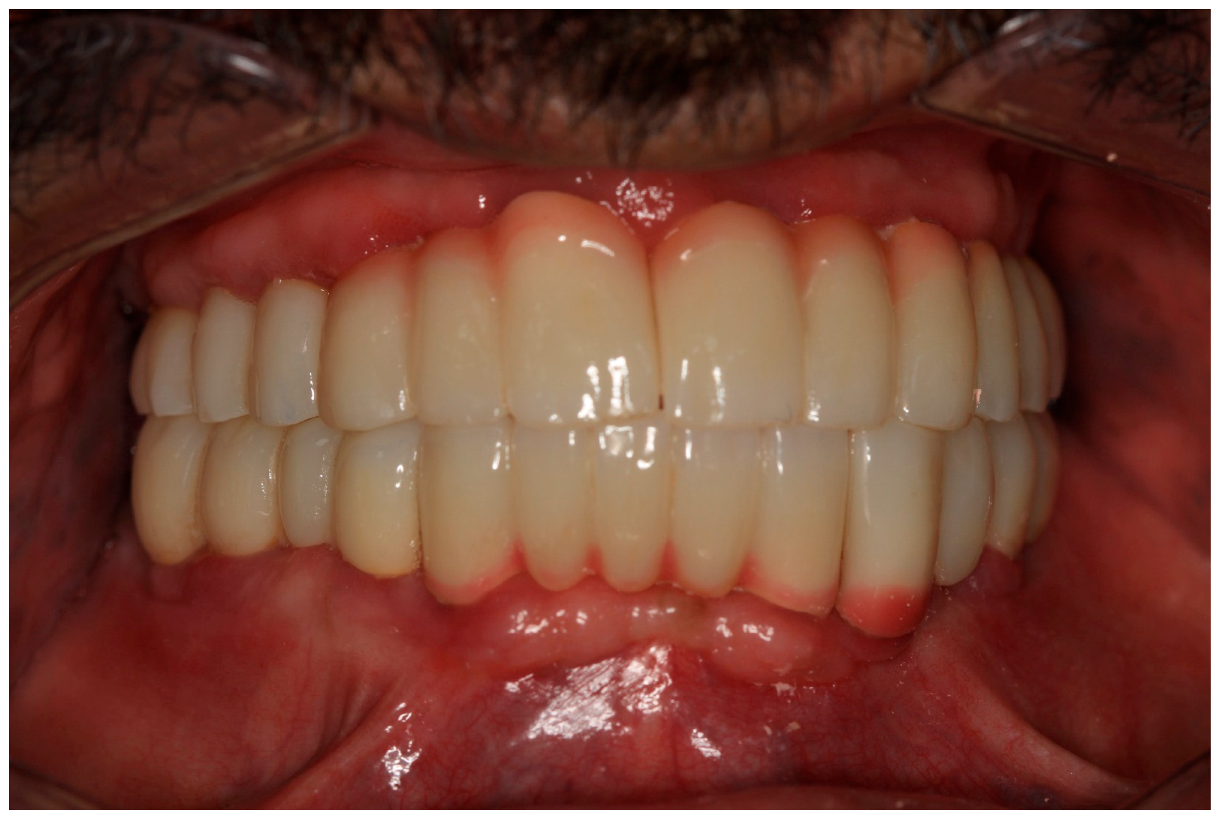 Prosthesis 07 00145 g016