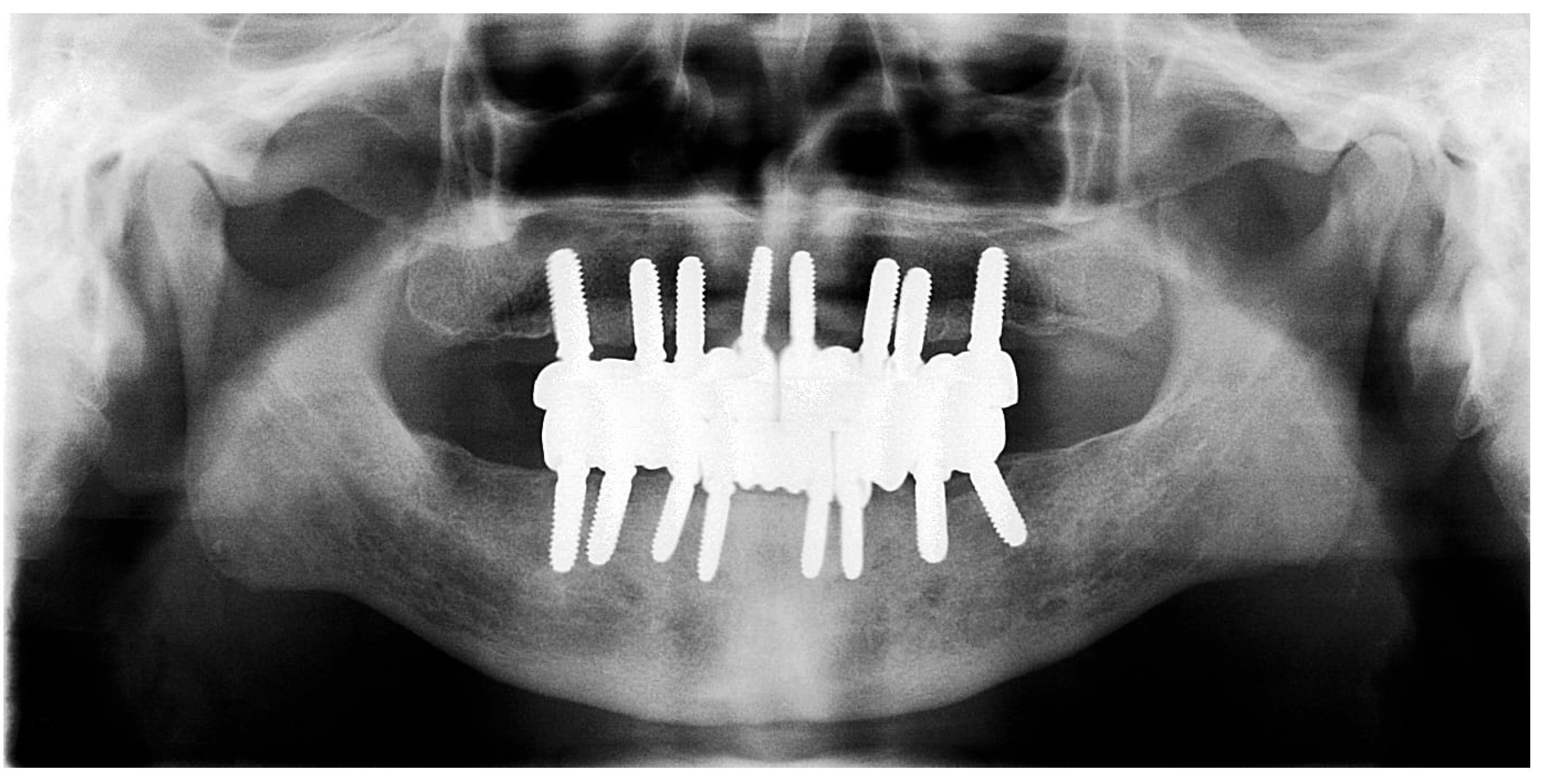 Prosthesis 07 00145 g017