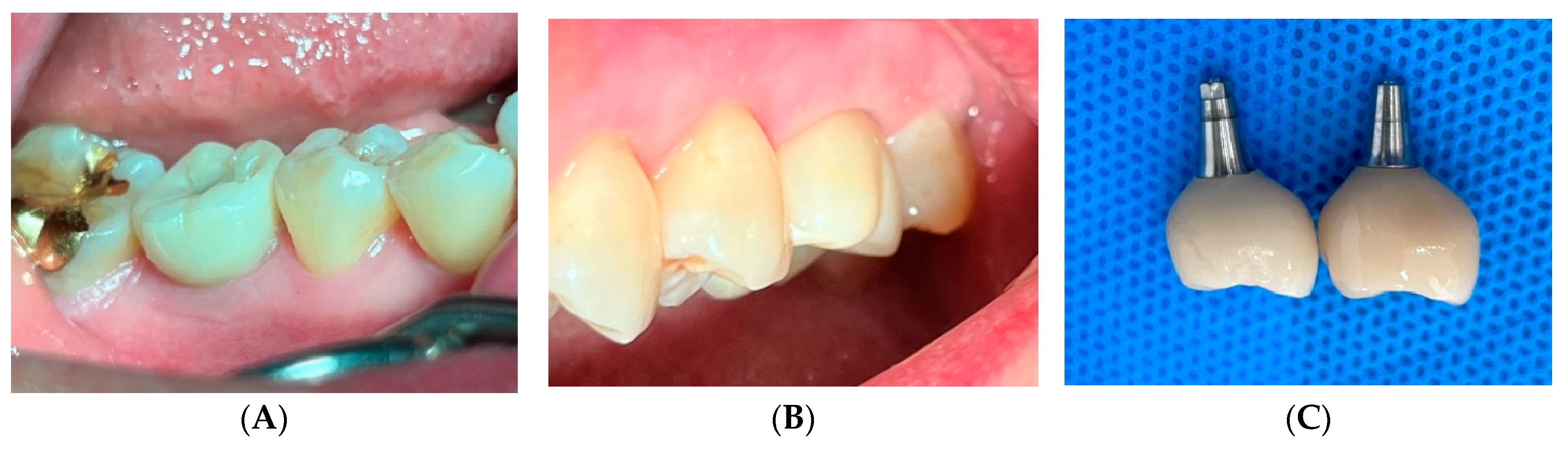Prosthesis 07 00146 g002