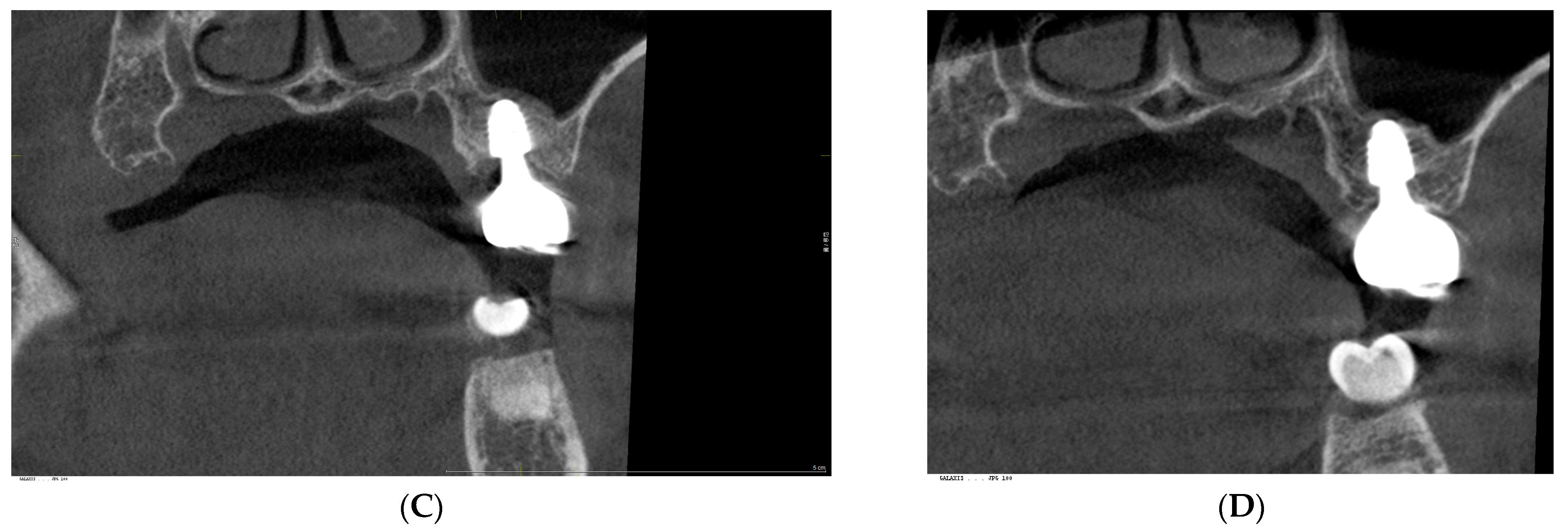 Prosthesis 07 00146 g003b