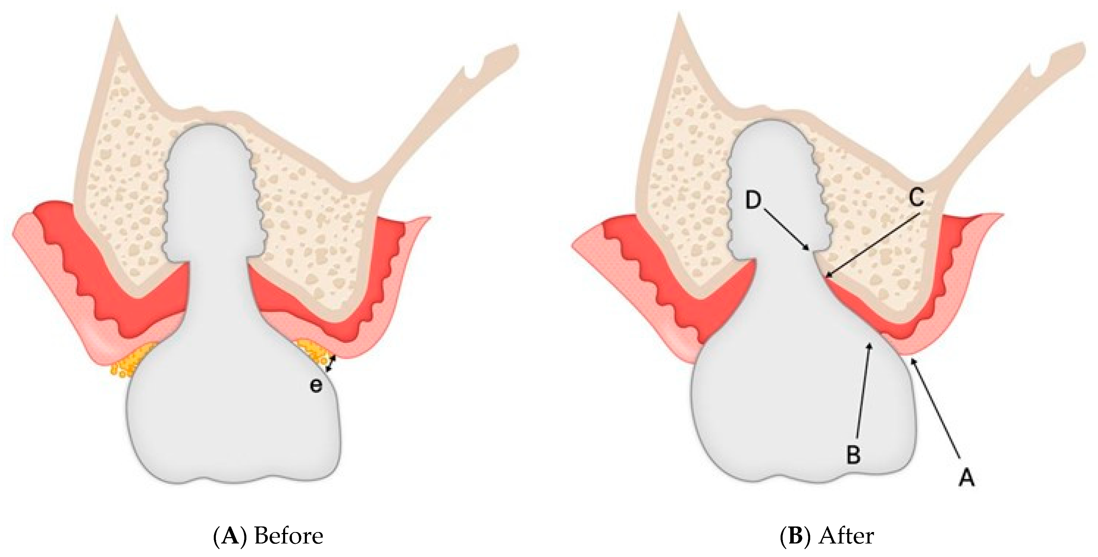 Prosthesis 07 00146 g004