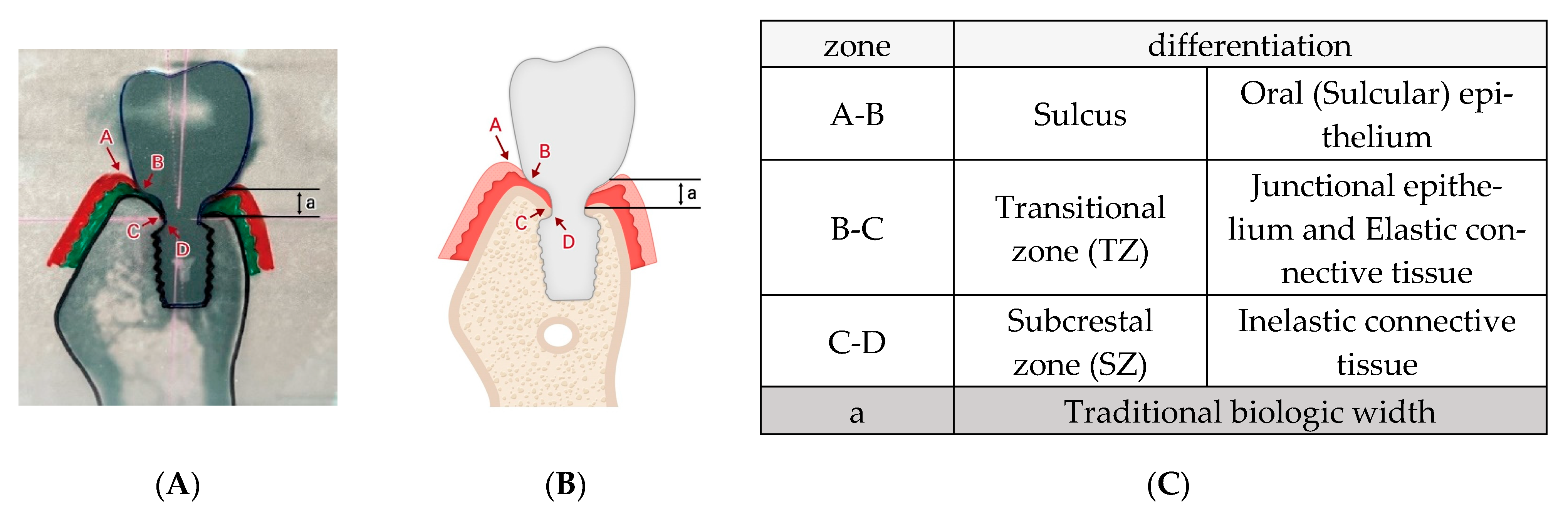 Prosthesis 07 00146 g006