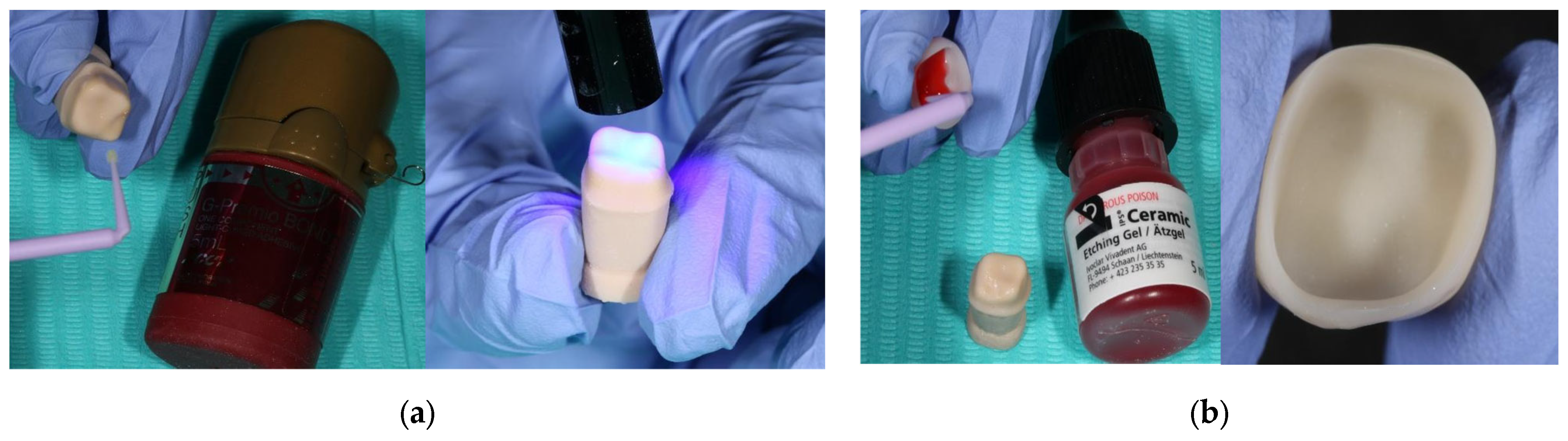 Prosthesis 07 00147 g001