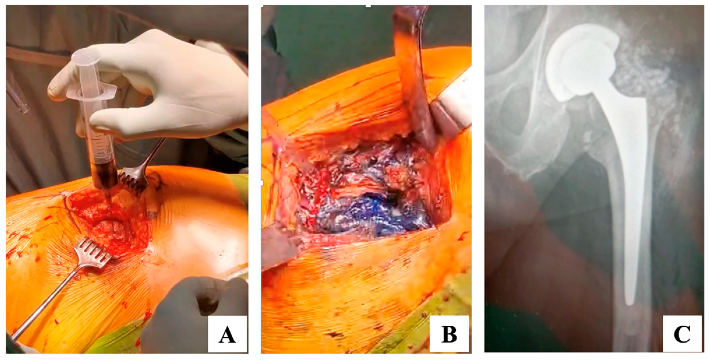 Prosthesis 07 00152 g003