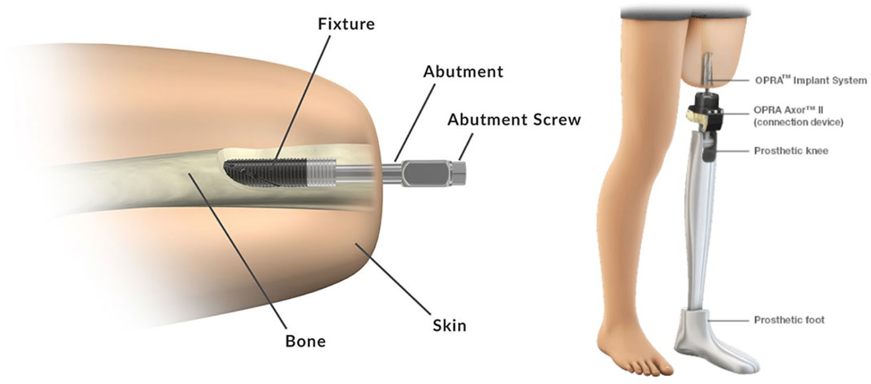 Prosthesis 07 00153 g002