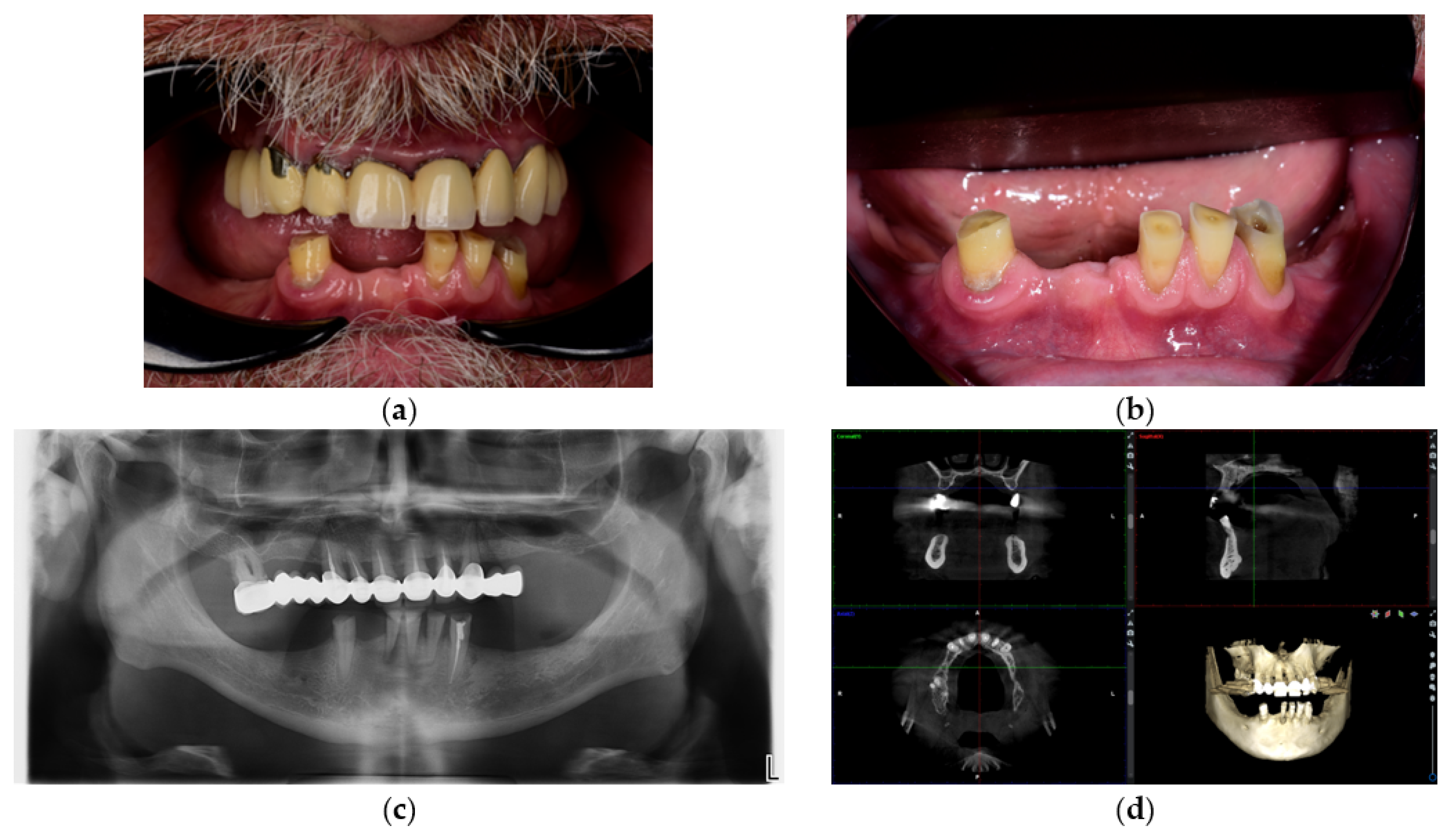 Prosthesis 07 00154 g001