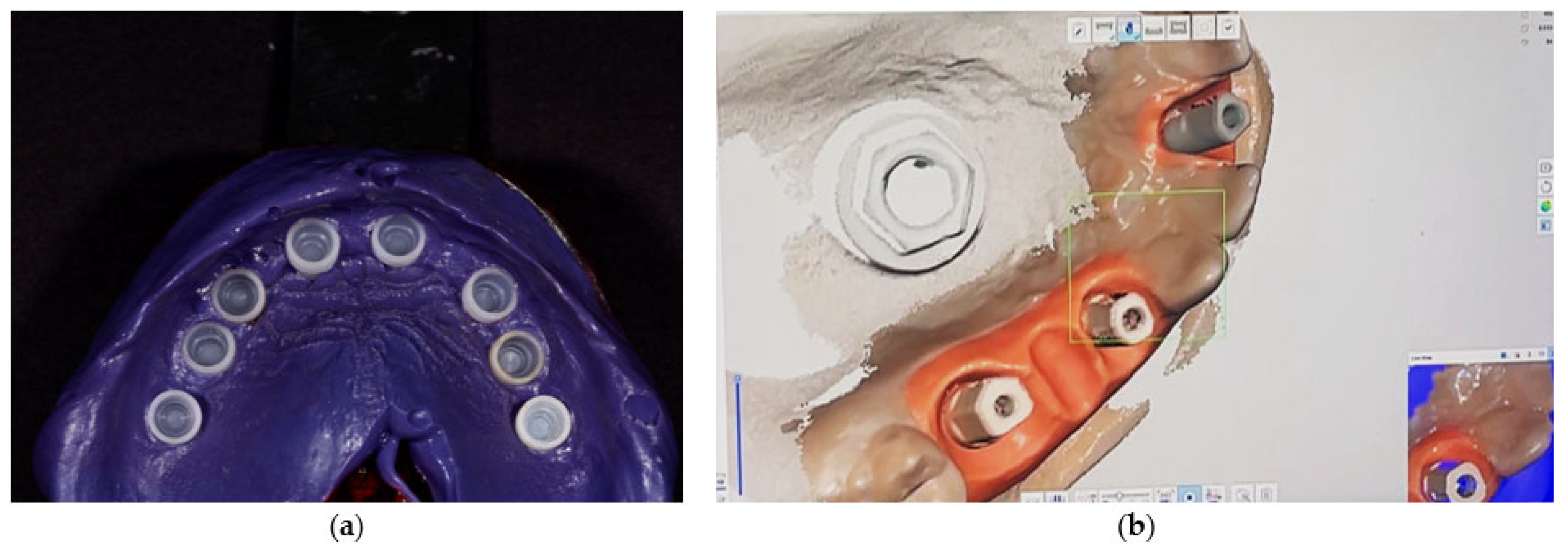 Prosthesis 07 00154 g002