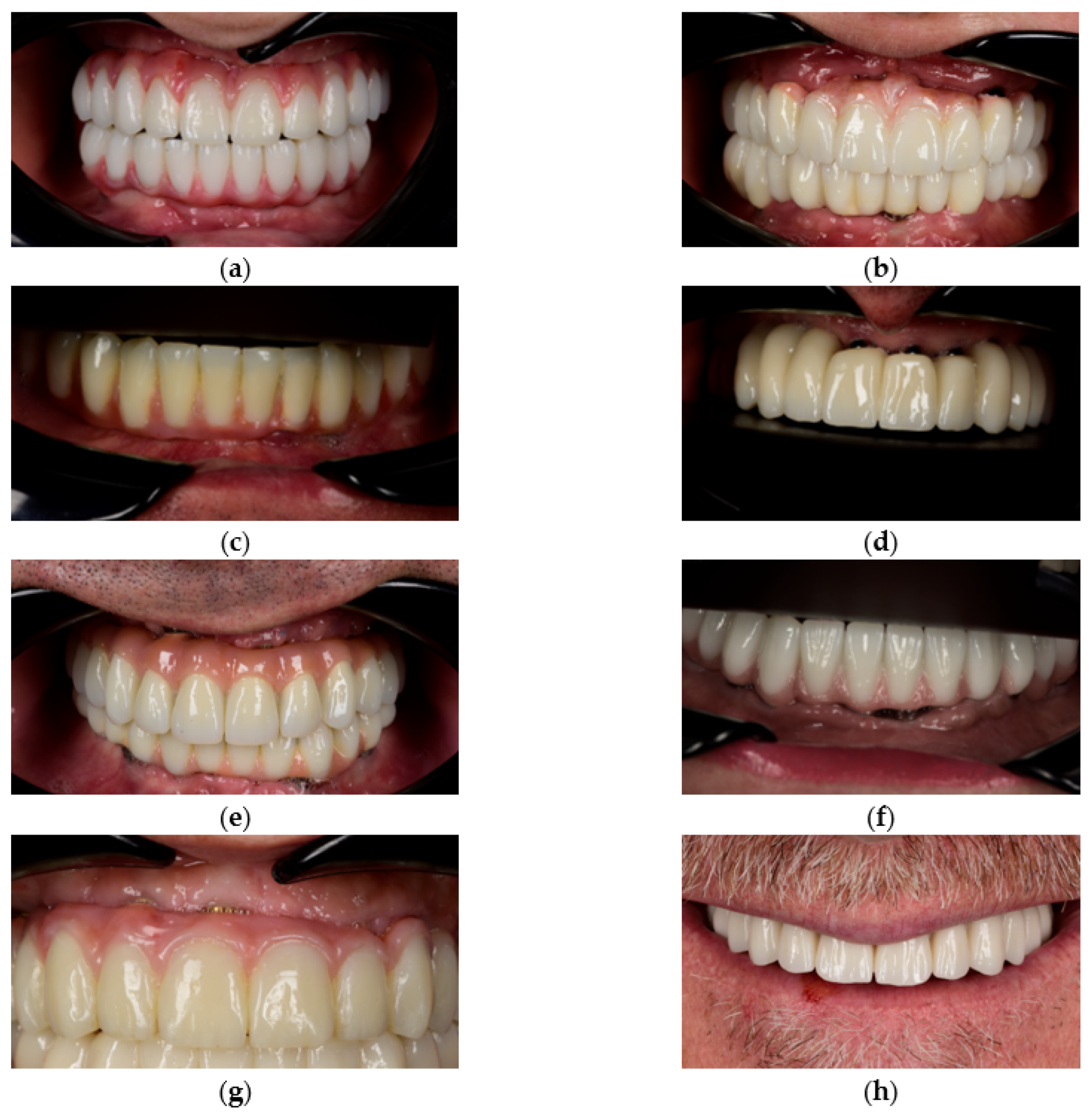 Prosthesis 07 00154 g005a