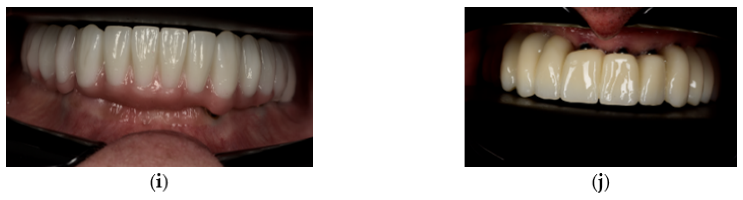 Prosthesis 07 00154 g005b