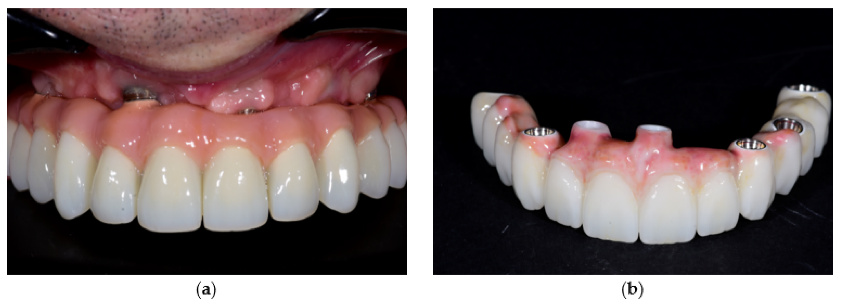 Prosthesis 07 00154 g008