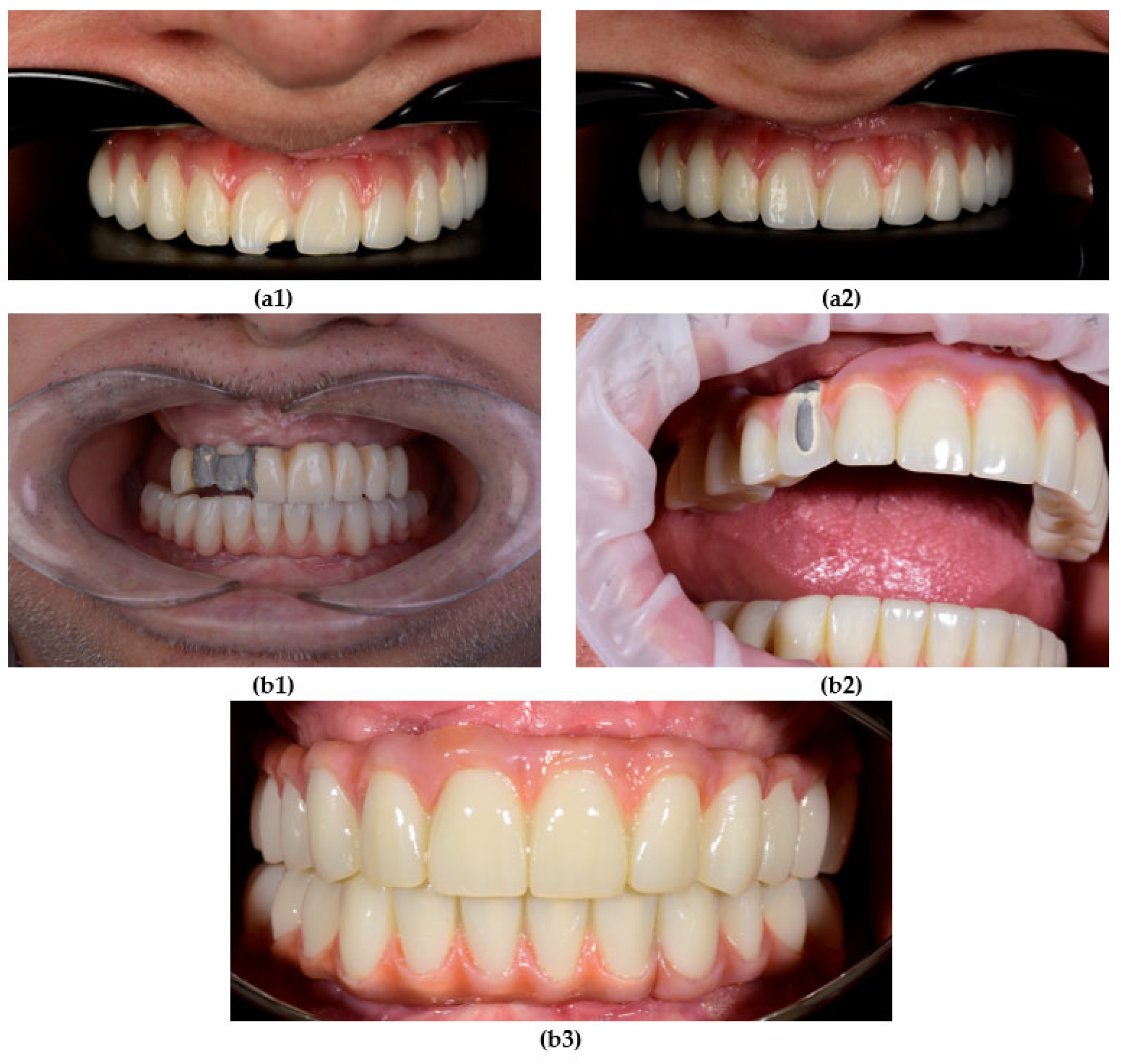 Prosthesis 07 00154 g009