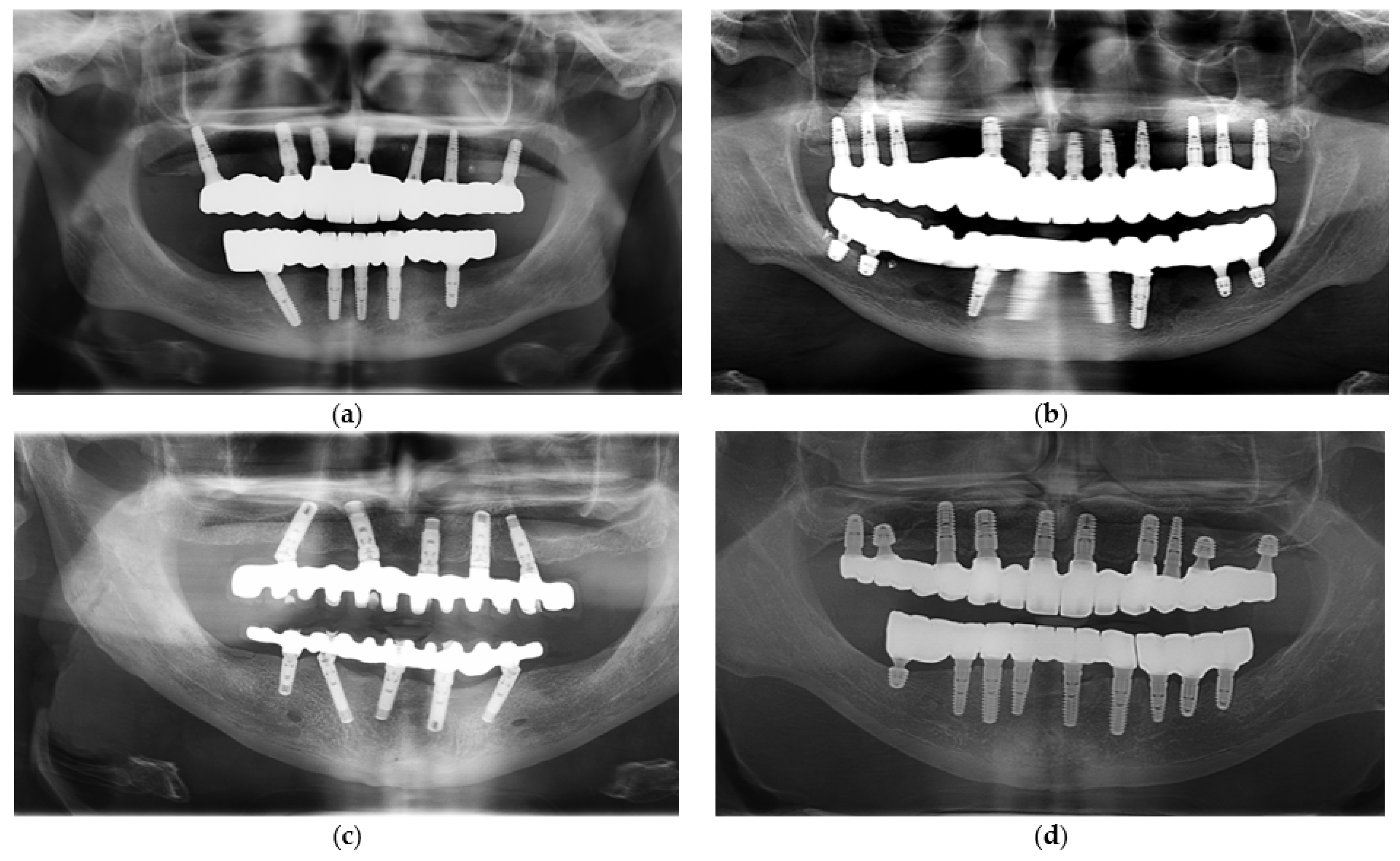 Prosthesis 07 00154 g013