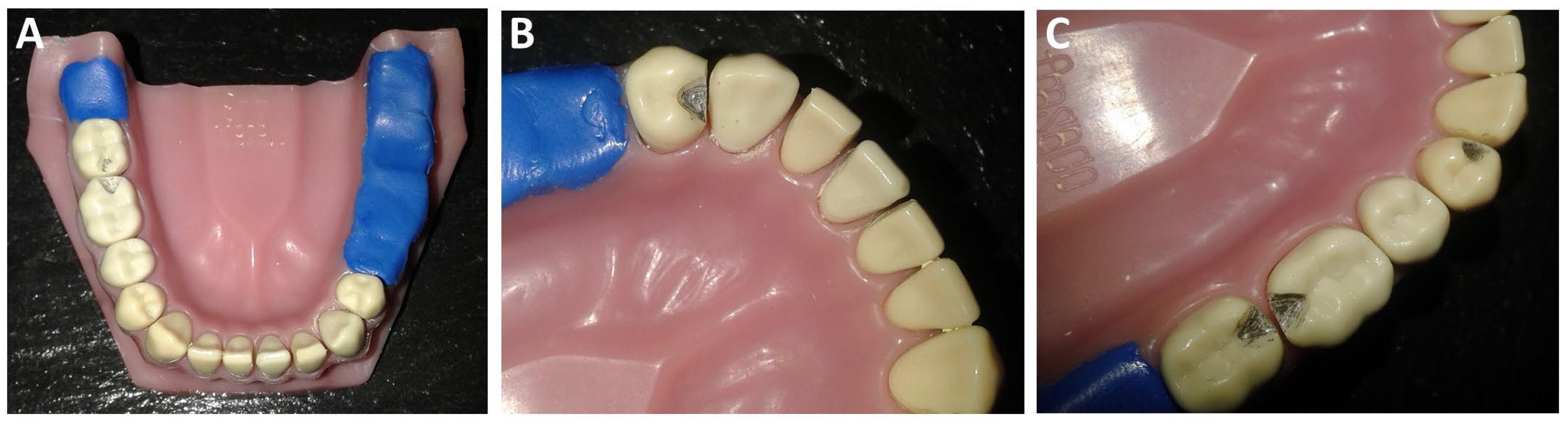 Prosthesis 07 00157 g001 Prosthesis 07 00157 g001