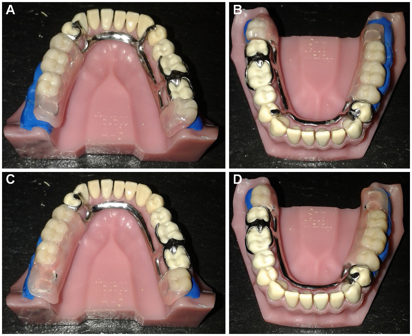 Prosthesis 07 00157 g003 Prosthesis 07 00157 g003