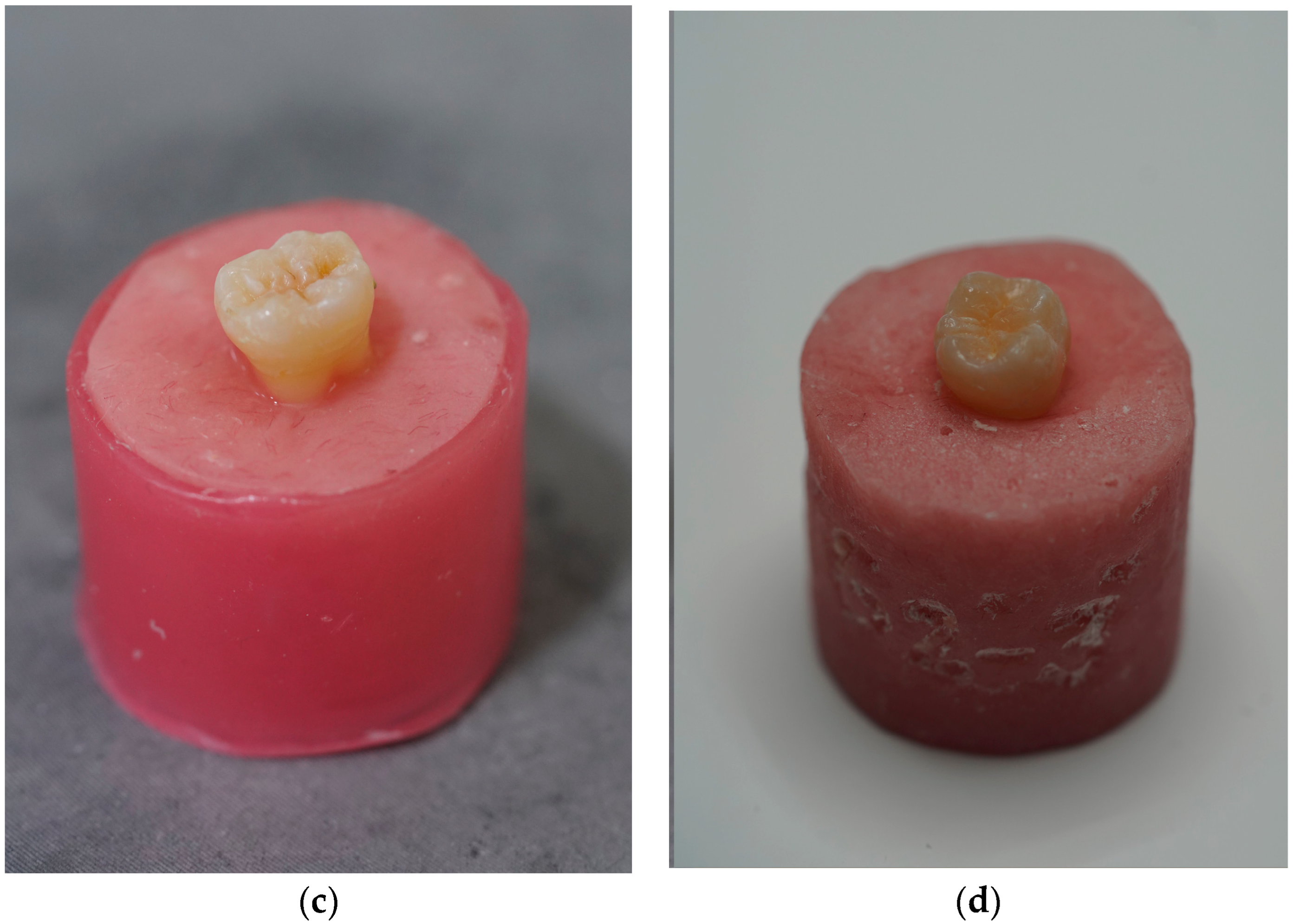 Prosthesis 07 00159 g002b Prosthesis 07 00159 g002b