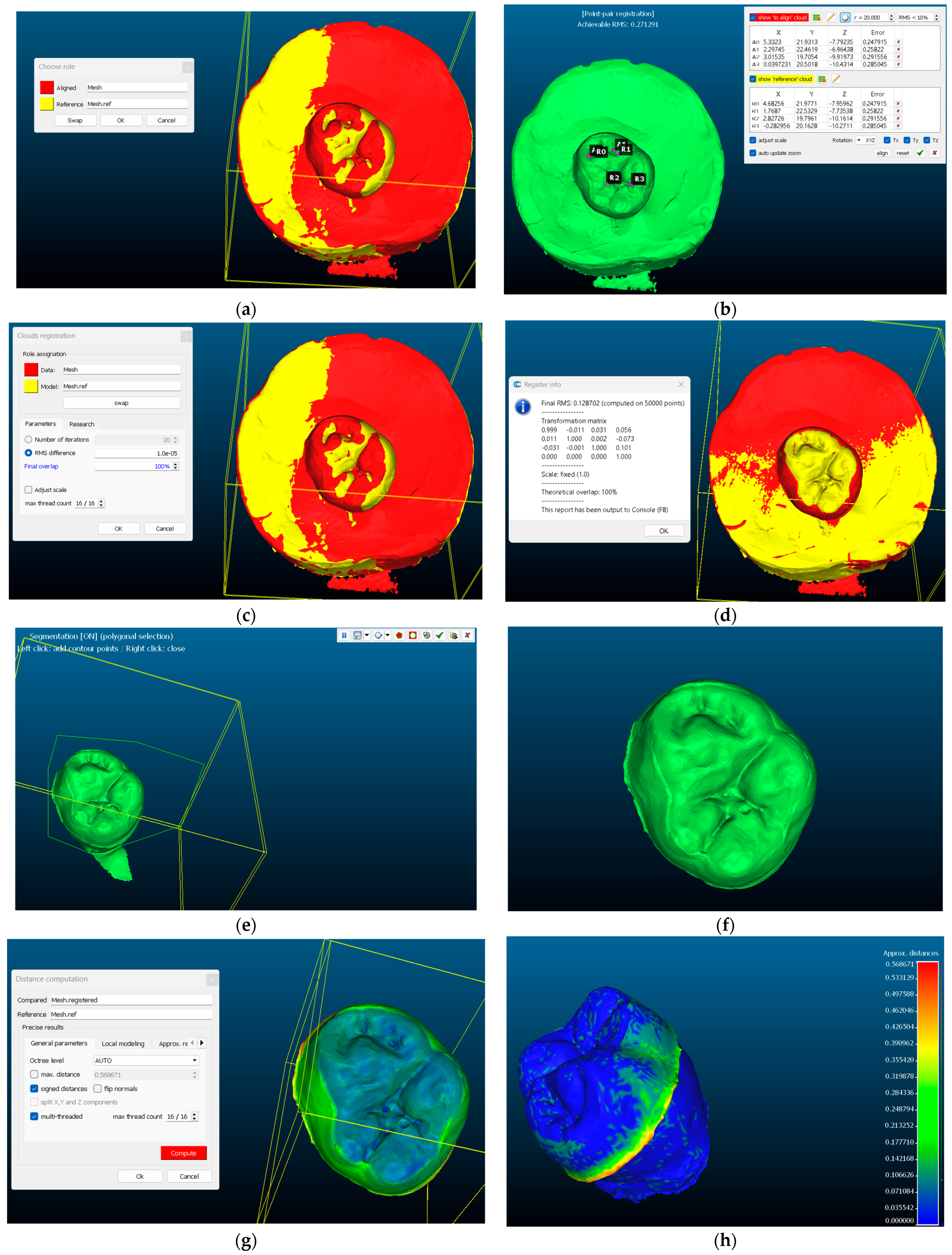 Prosthesis 07 00159 g004 Prosthesis 07 00159 g004