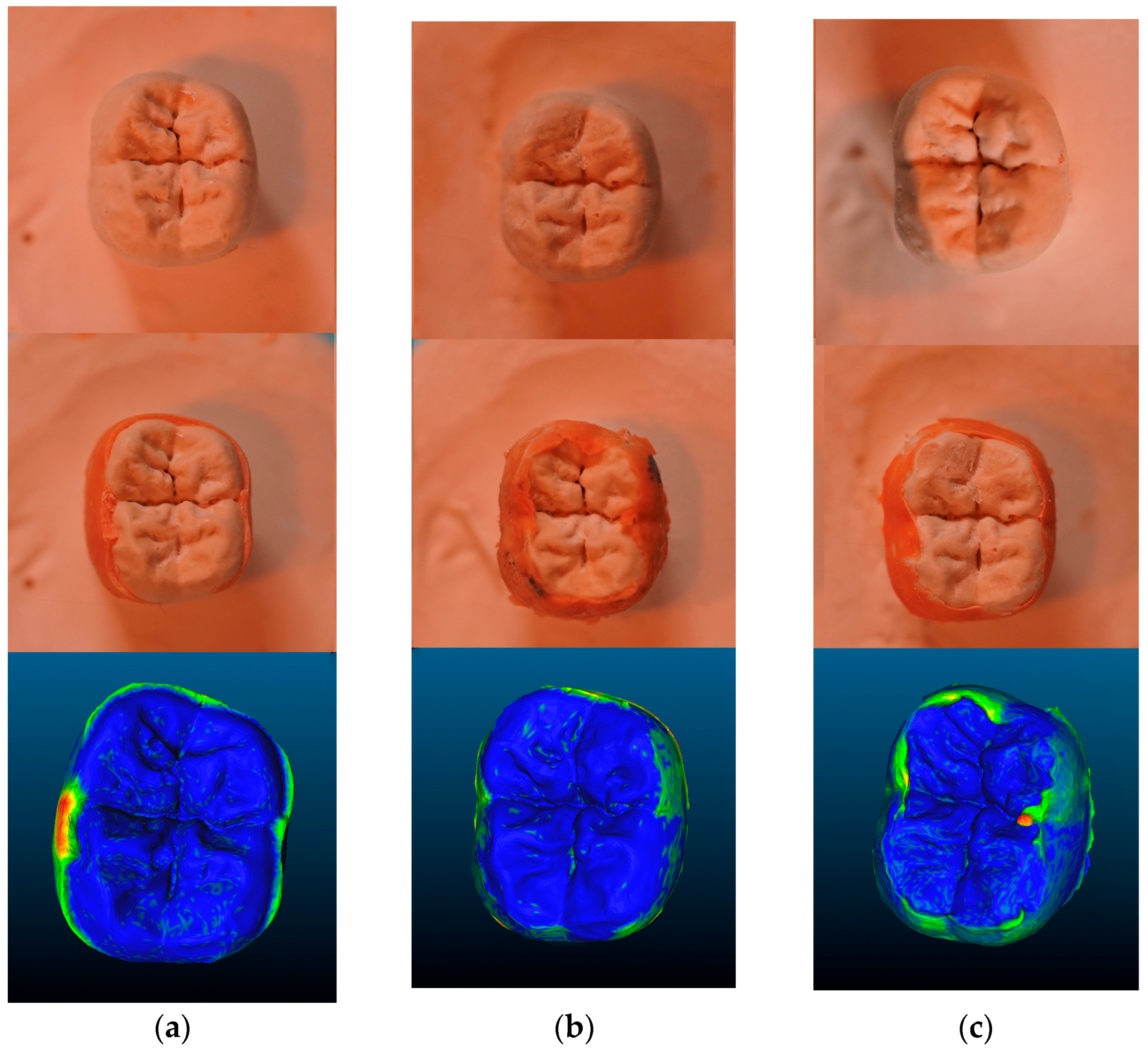 Prosthesis 07 00159 g005 Prosthesis 07 00159 g005