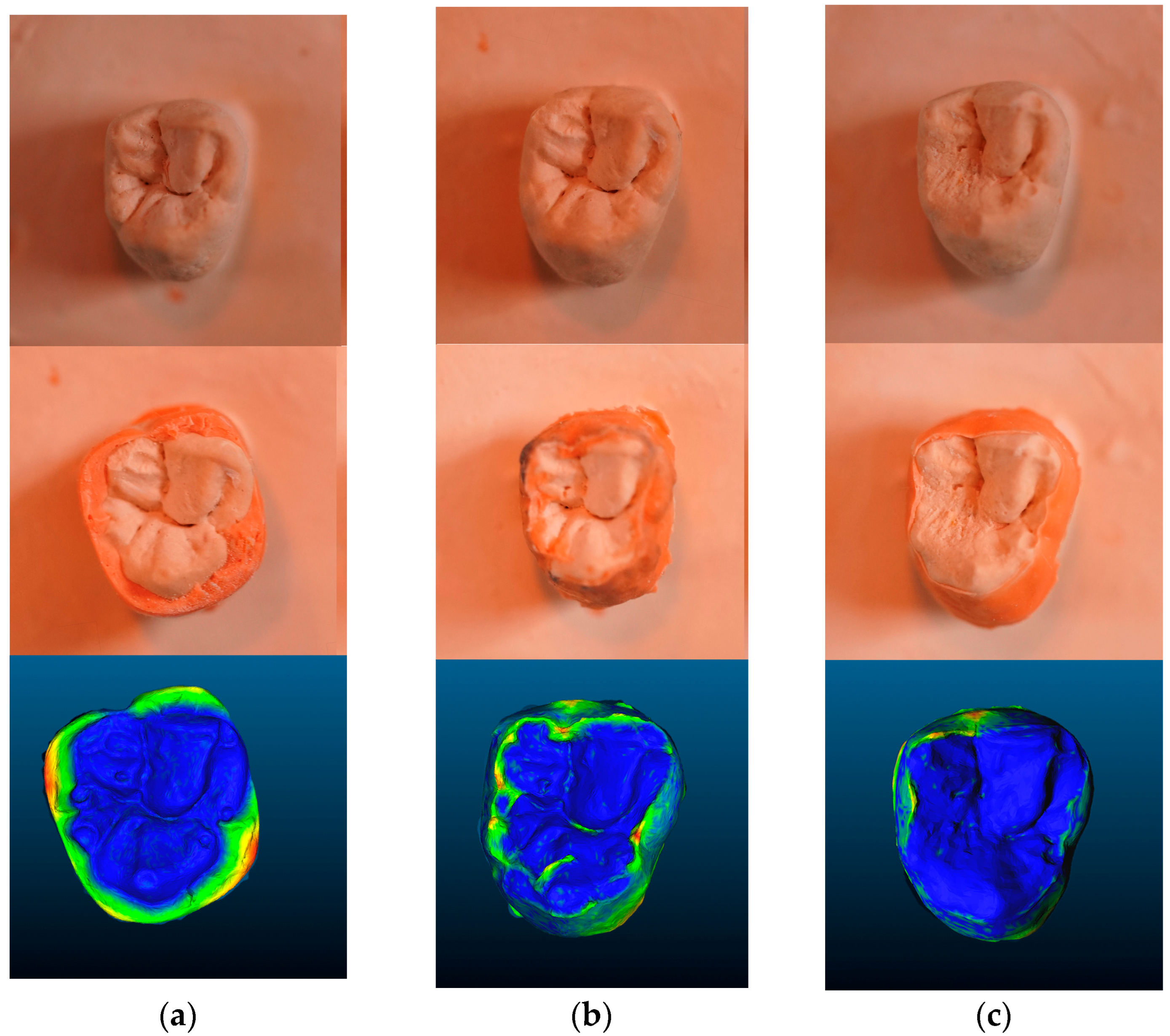 Prosthesis 07 00159 g006 Prosthesis 07 00159 g006