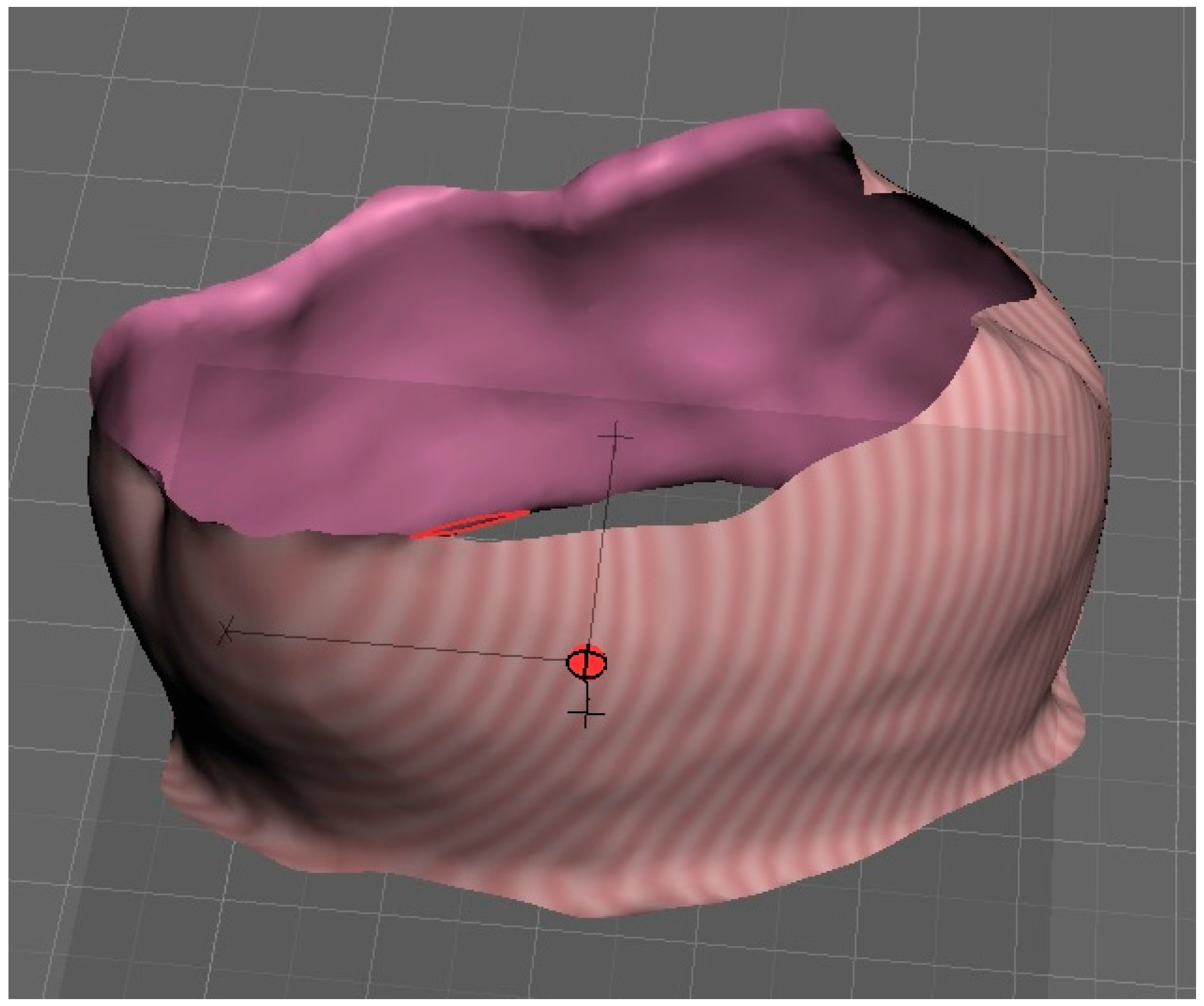 Prosthesis 07 00159 g008 Prosthesis 07 00159 g008