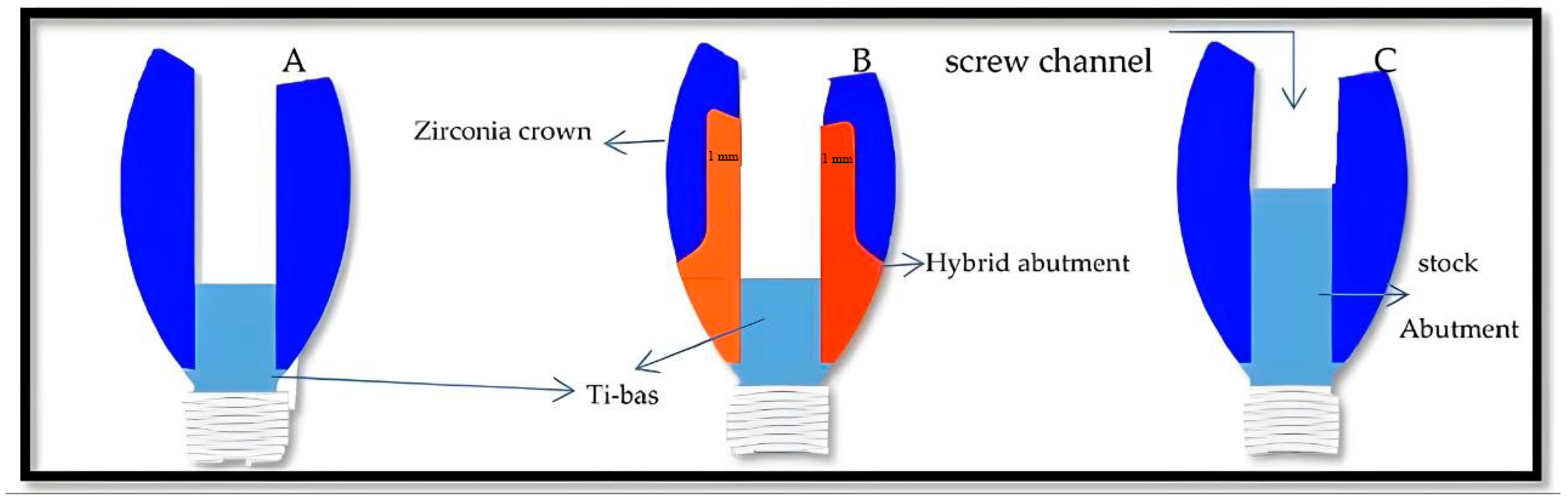 Prosthesis 07 00161 g001
