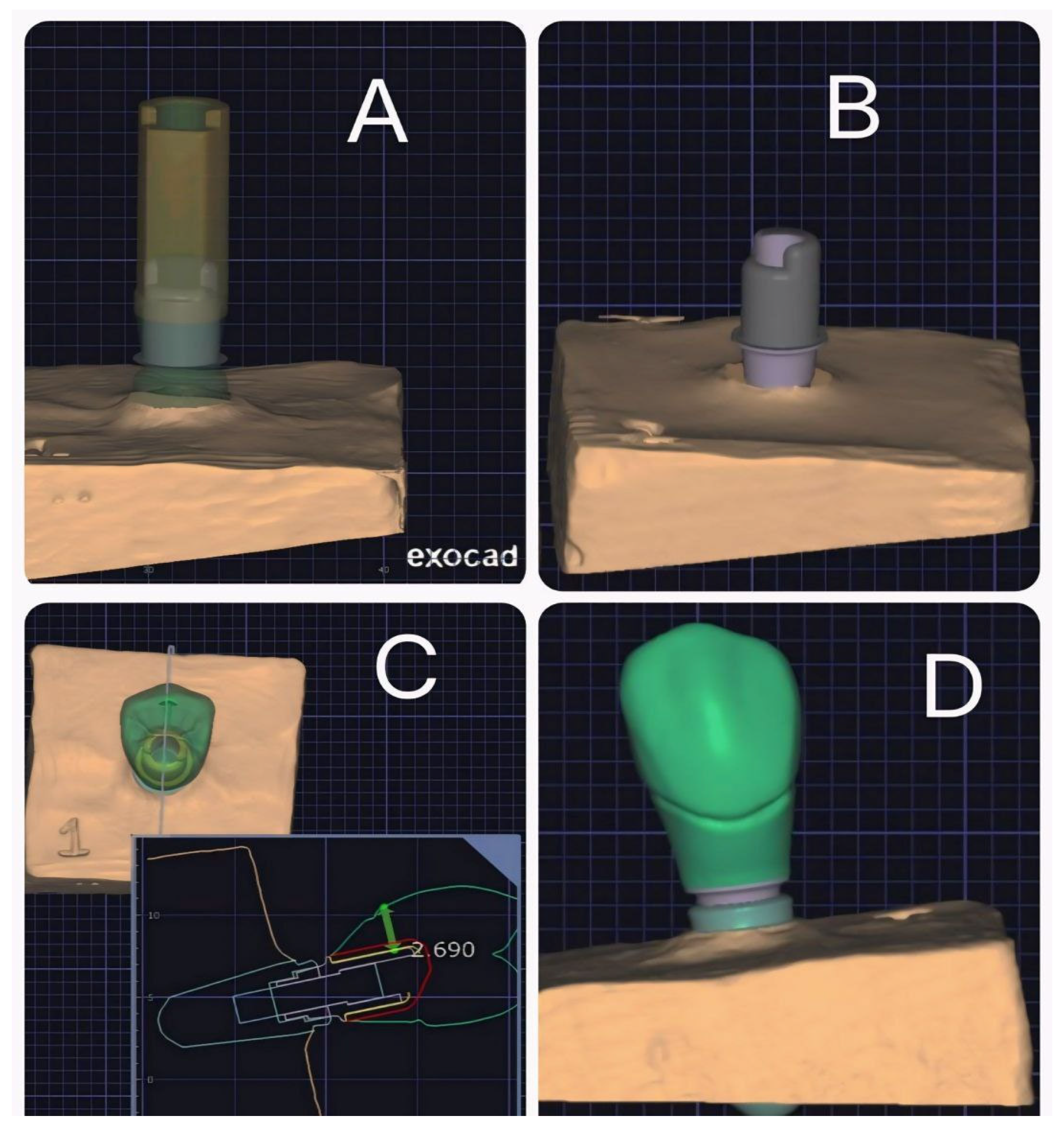 Prosthesis 07 00161 g002