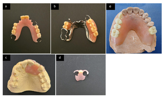The Use of the Flexible Thermoplastic Nylon-Based Dental Prostheses: A ...