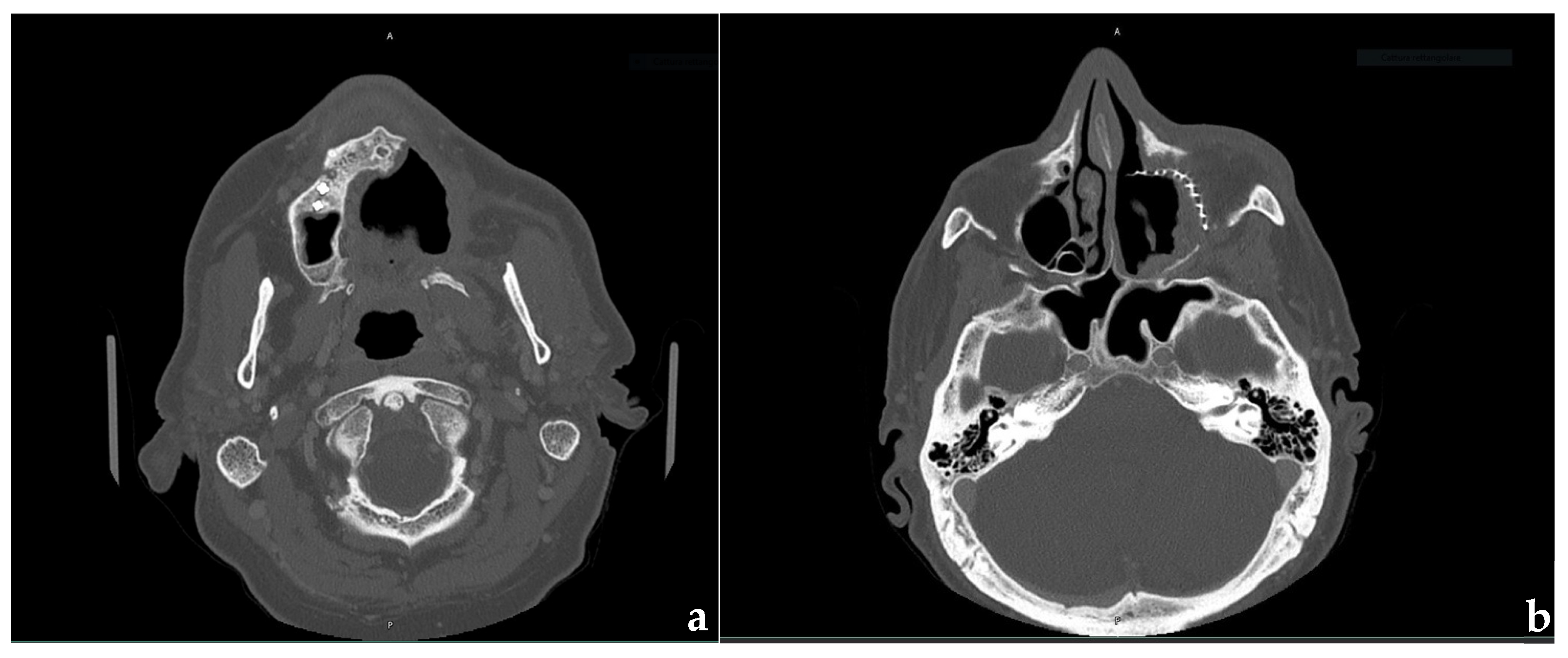 Prosthesis 08 00006 g002