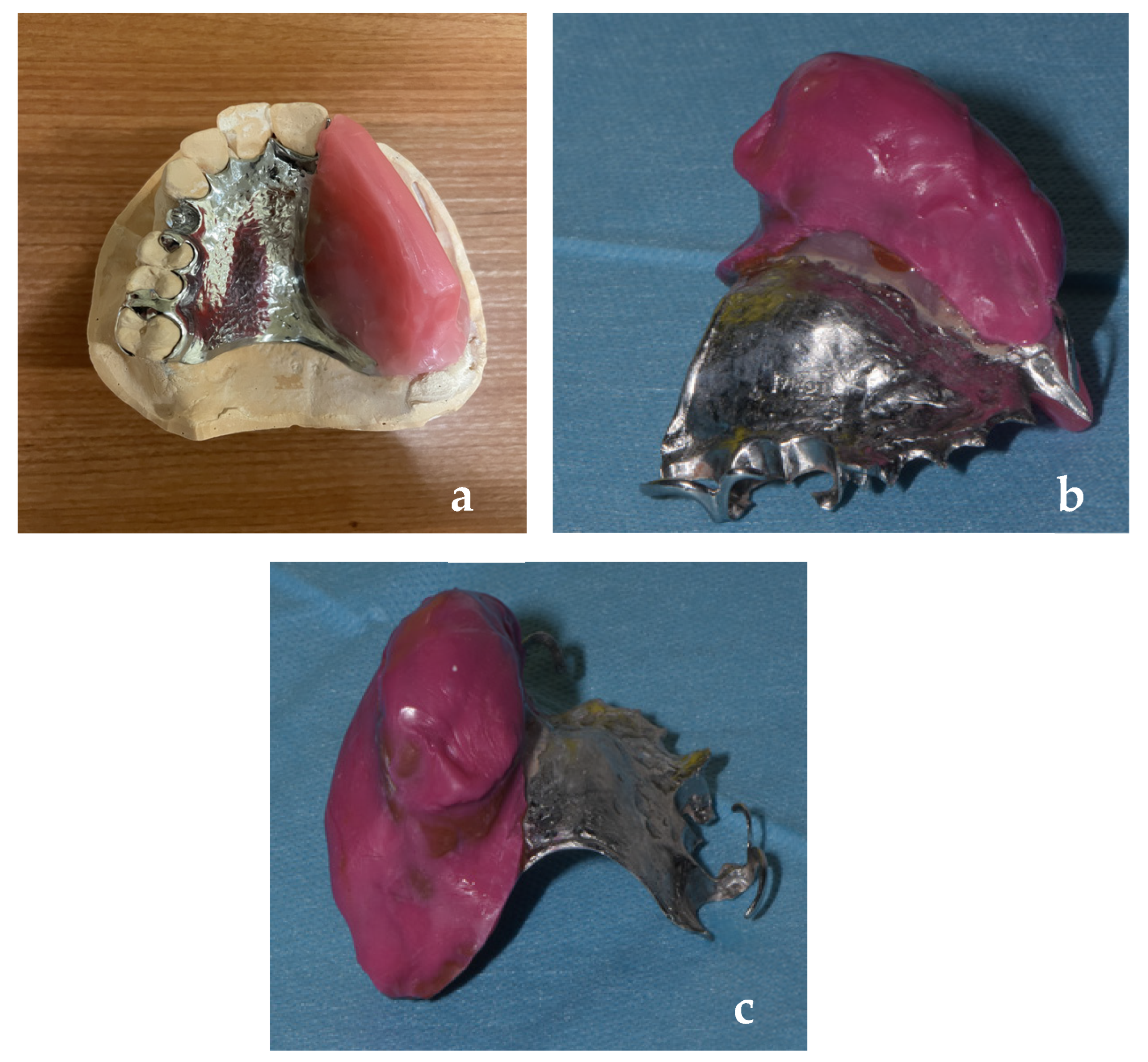 Prosthesis 08 00006 g005