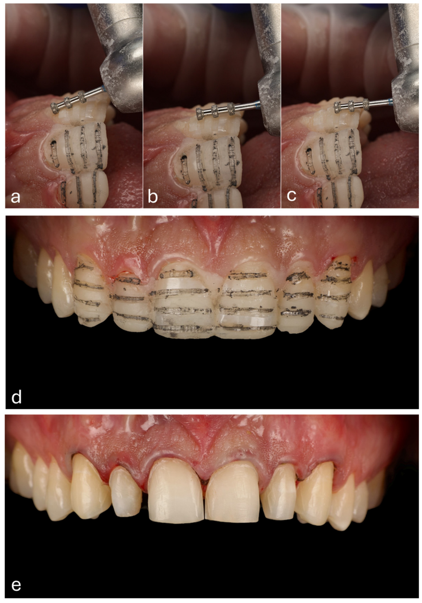 Prosthesis 08 00045 g006