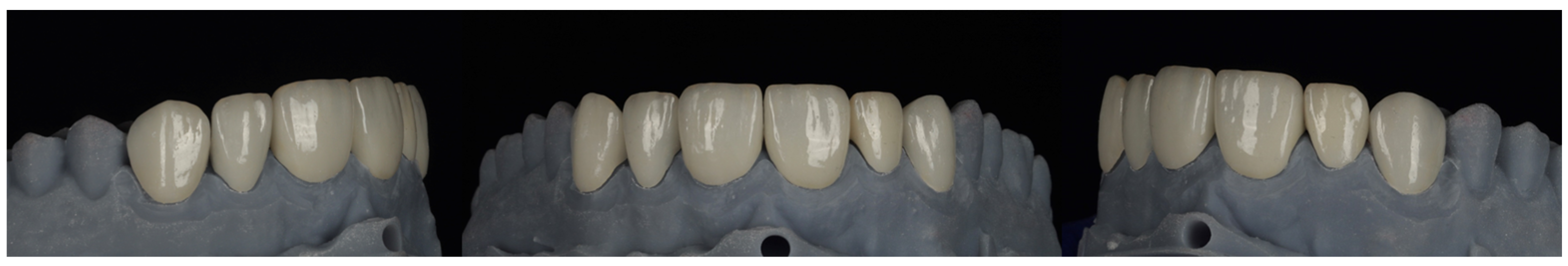 Prosthesis 08 00045 g010