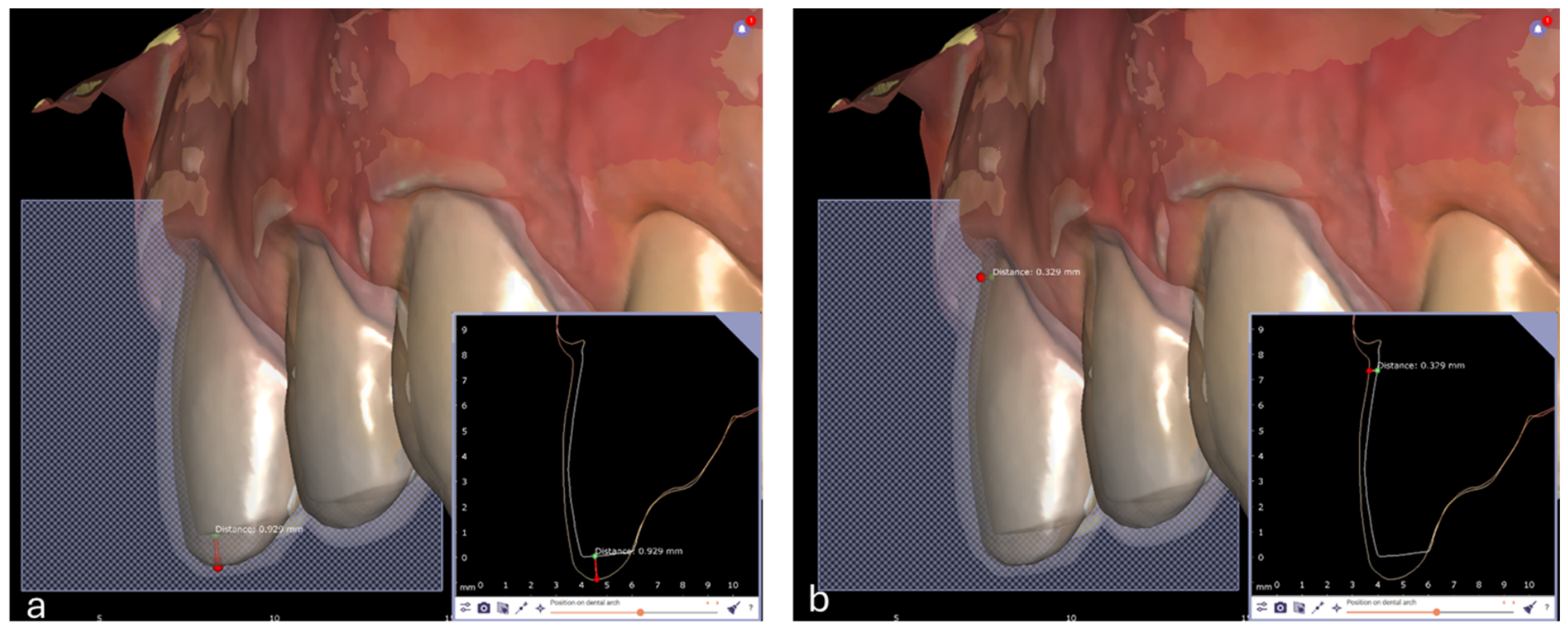 Prosthesis 08 00045 g018