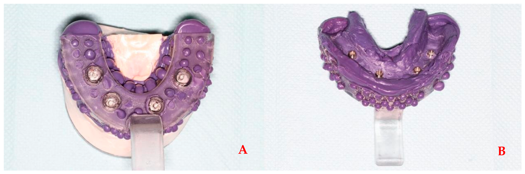 Prosthesis 08 00095 g007 Prosthesis 08 00095 g007