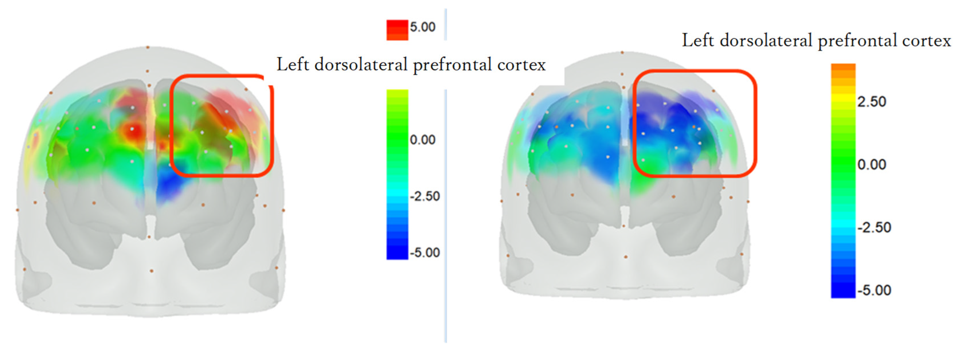 Psychiatryint 05 00010 g005 Psychiatryint 05 00010 g005