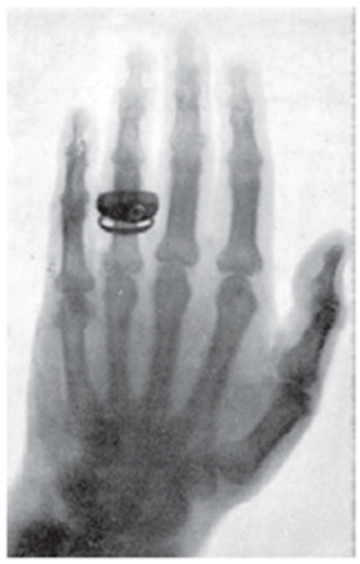 QuBS Free FullText Discovery of Xrays—Its Impact in India and