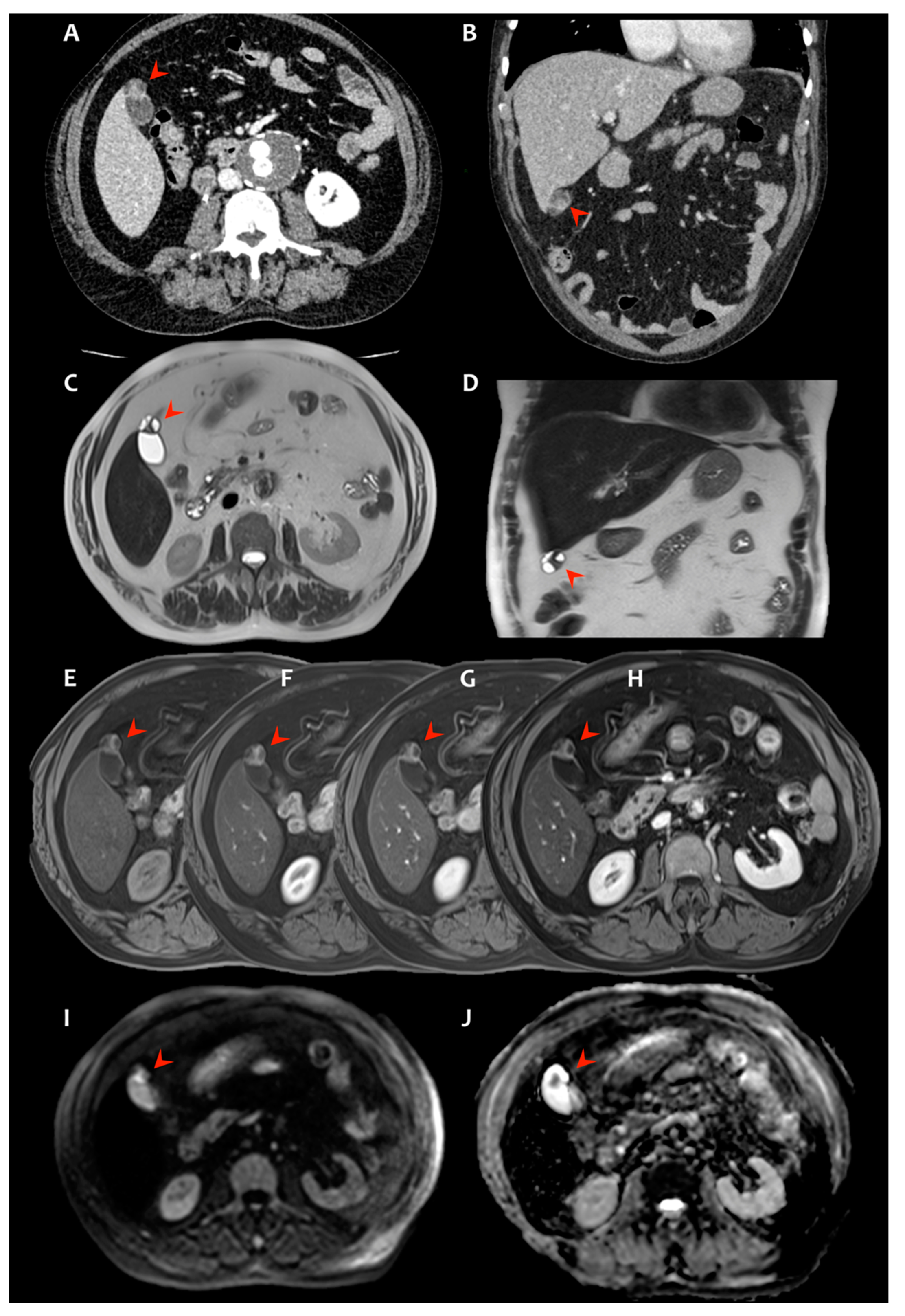 Radiation 02 00004 g001 Radiation 02 00004 g001