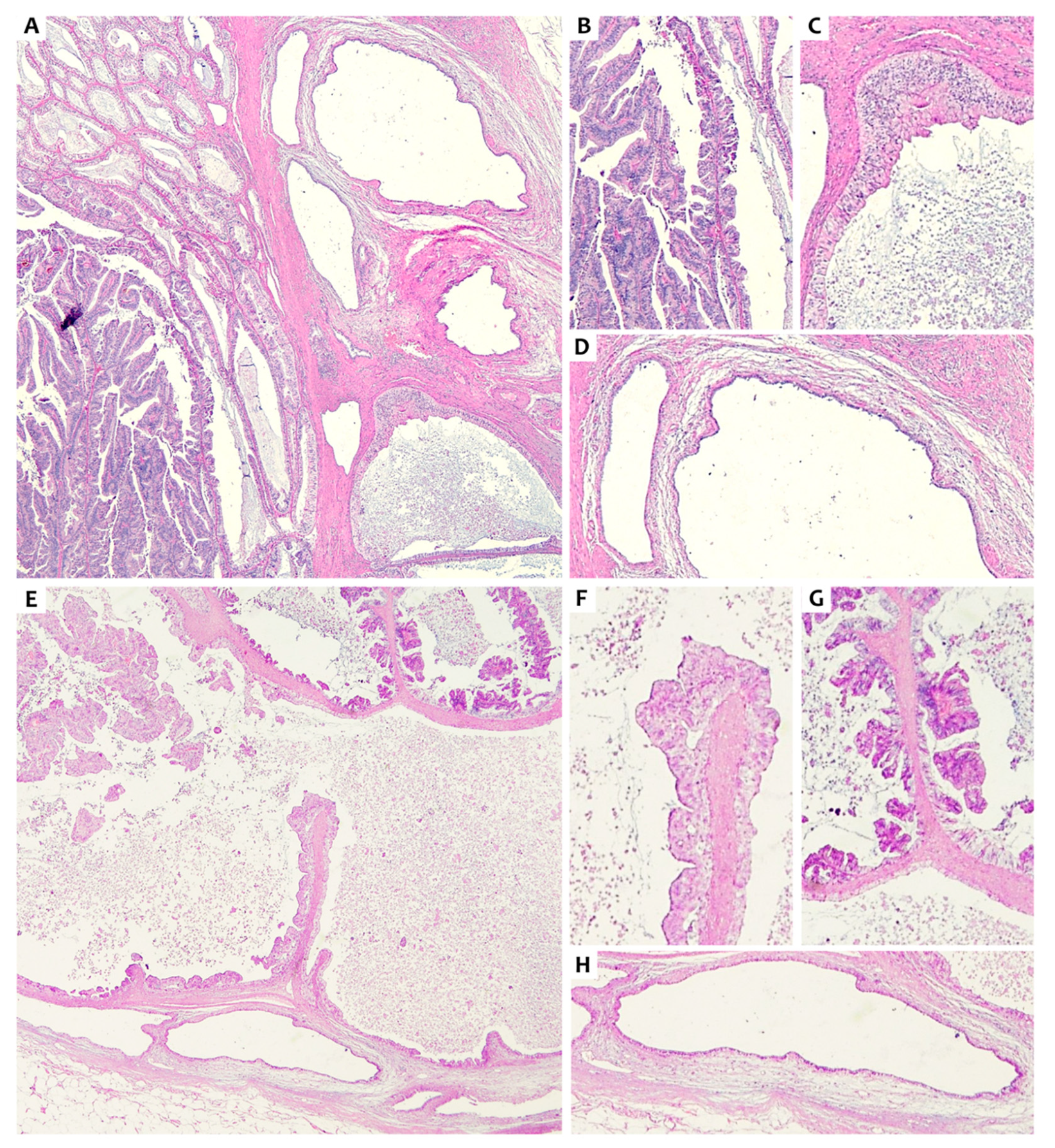 Radiation 02 00004 g002 Radiation 02 00004 g002
