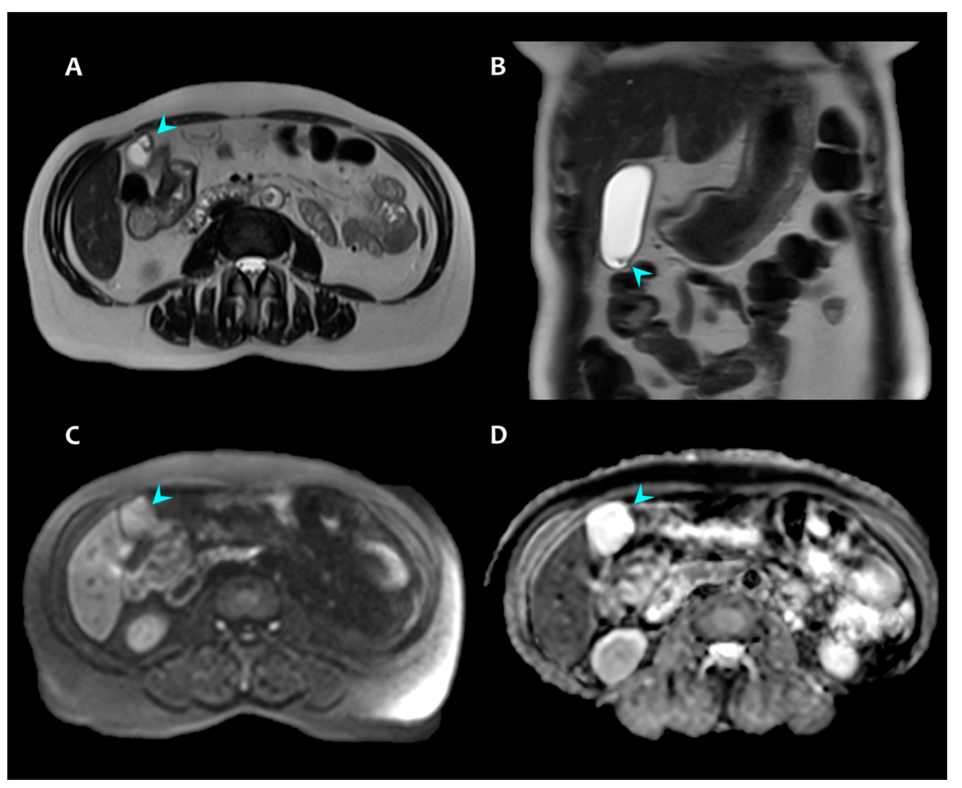 Radiation 02 00004 g003 Radiation 02 00004 g003
