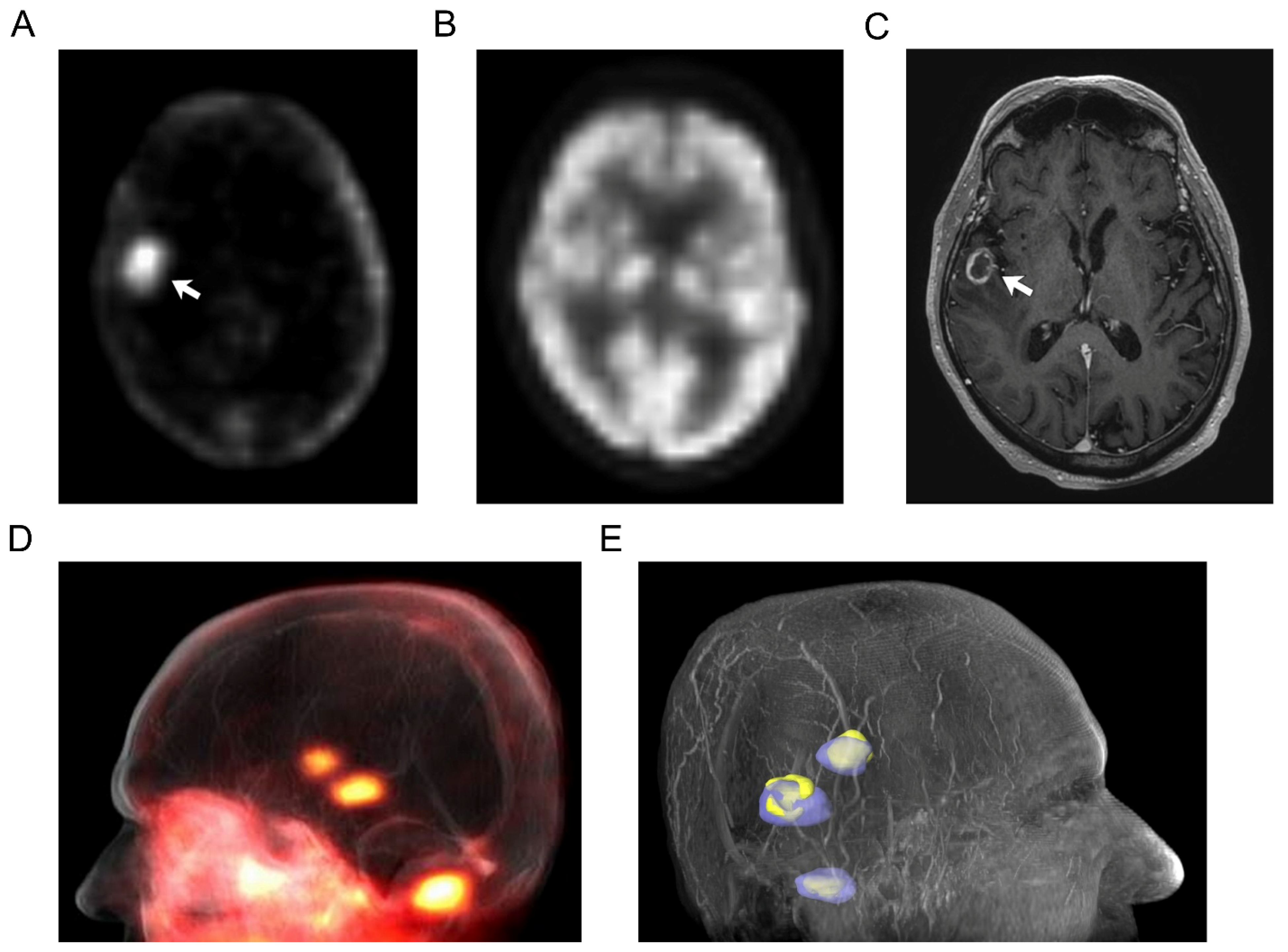 Radiation 02 00015 g001
