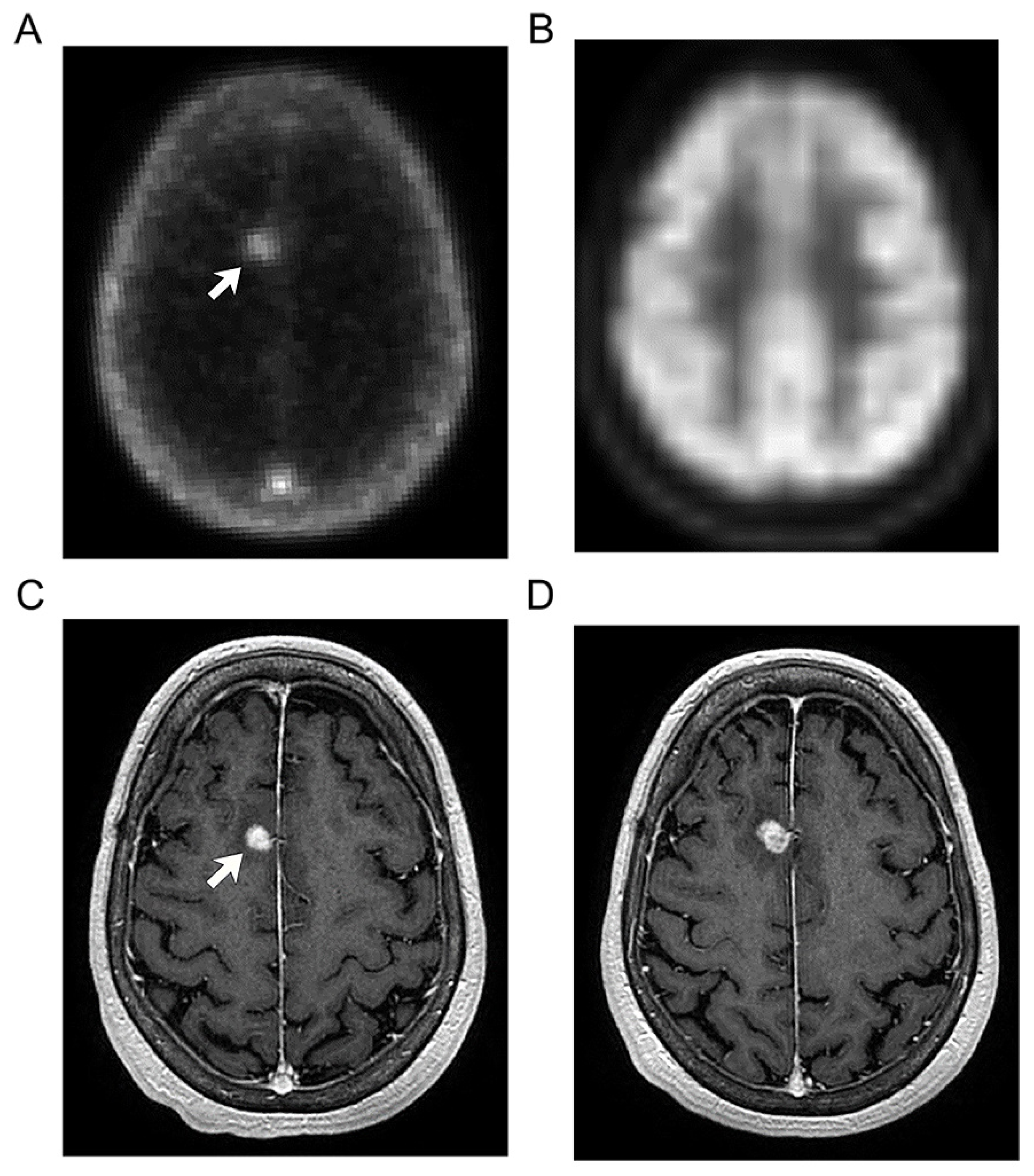 Radiation 02 00015 g002