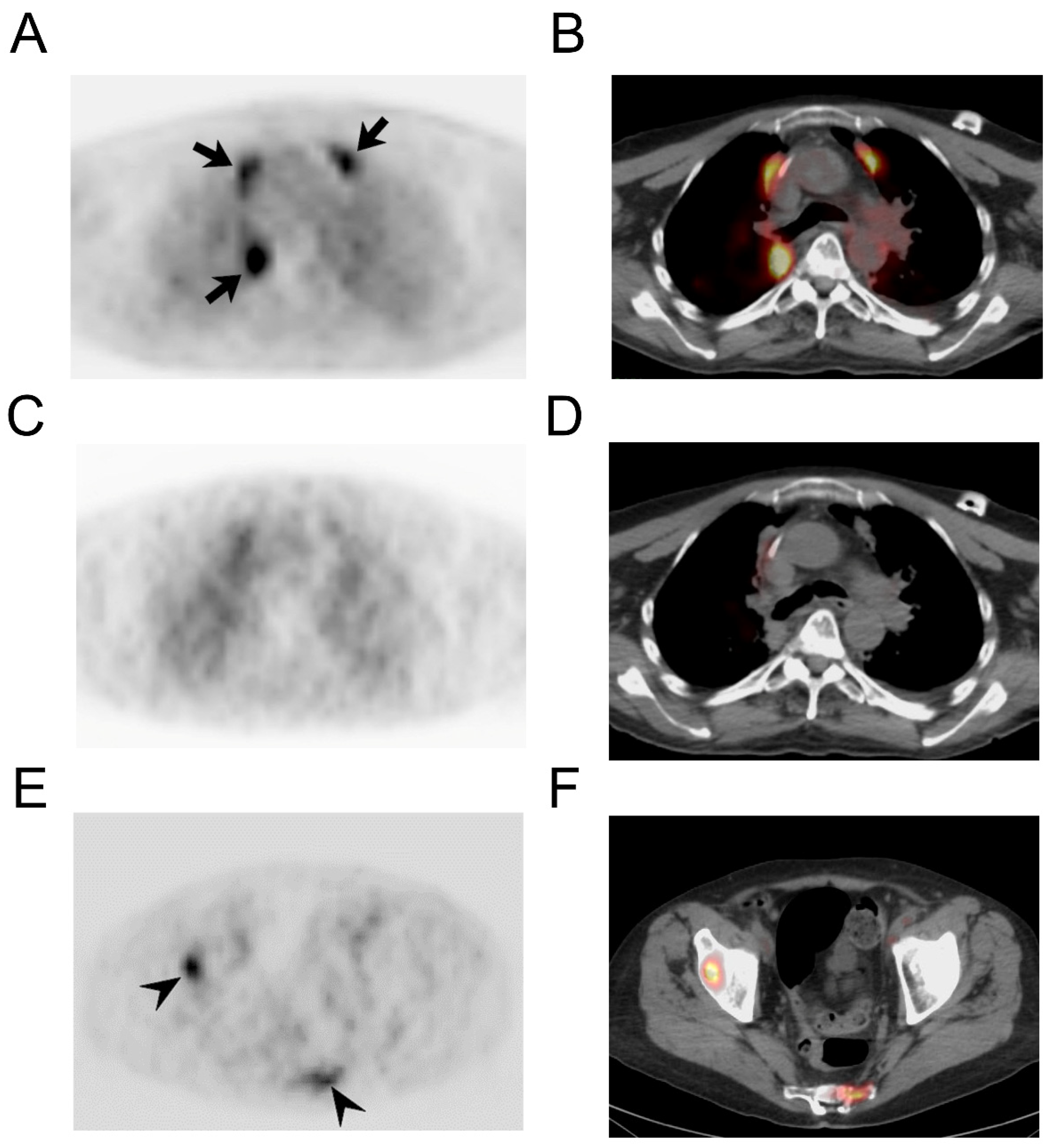 Radiation 02 00015 g004