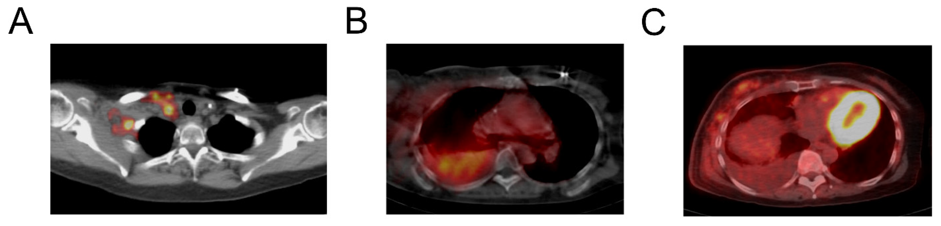 Radiation 02 00015 g005