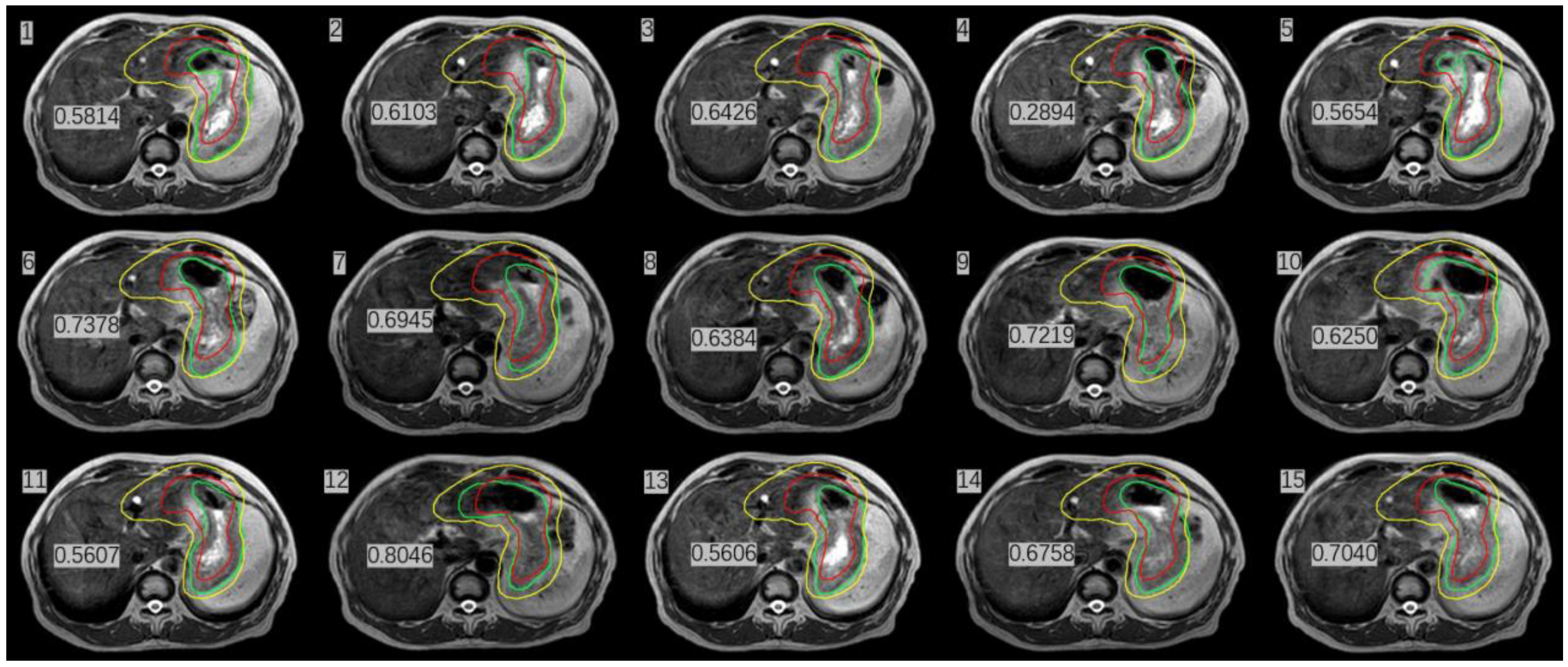 Radiation 02 00019 g004